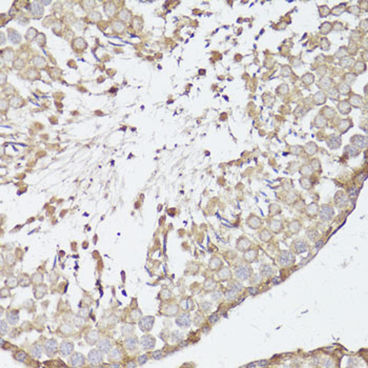 Immunohistochemistry of paraffin-embedded Rat testis using OPRK1 Polyclonal Antibody at dilution of  1:100 (40x lens).