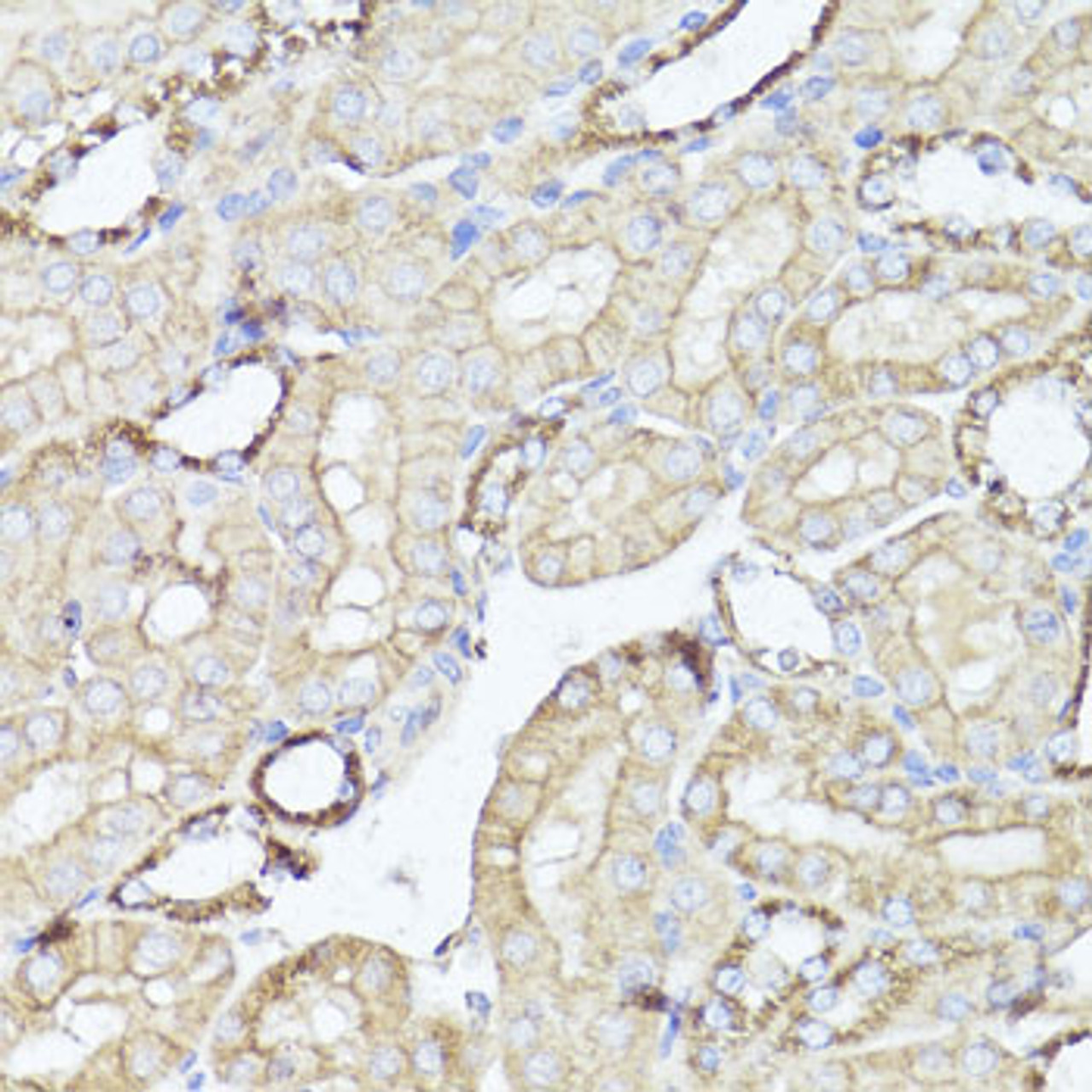 Immunohistochemistry of paraffin-embedded Mouse kidney using OPRK1 Polyclonal Antibody at dilution of  1:100 (40x lens).