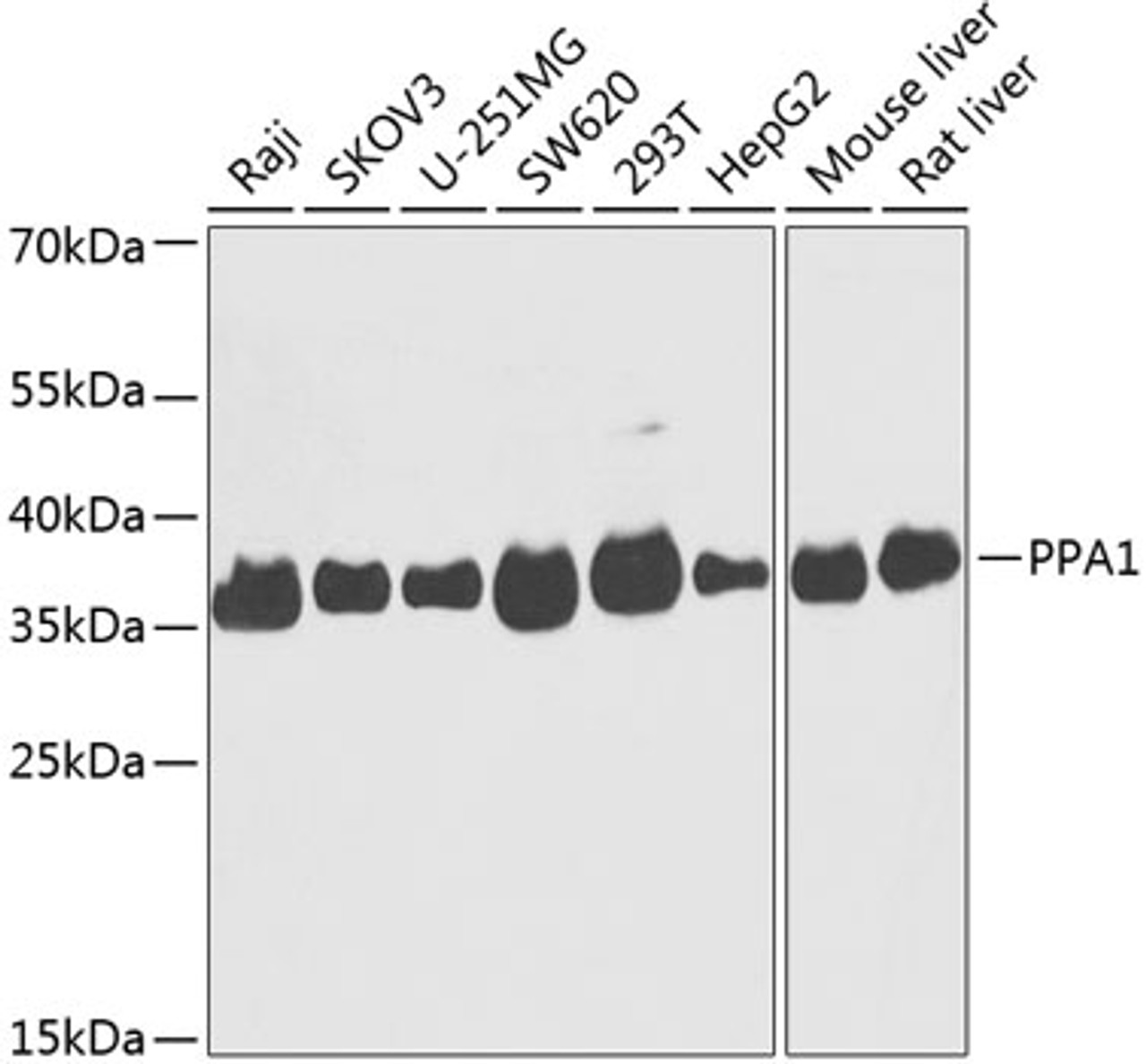 Western blot analysis of extracts of various cell lines using PPA1 Polyclonal Antibody at dilution of 1:1000.