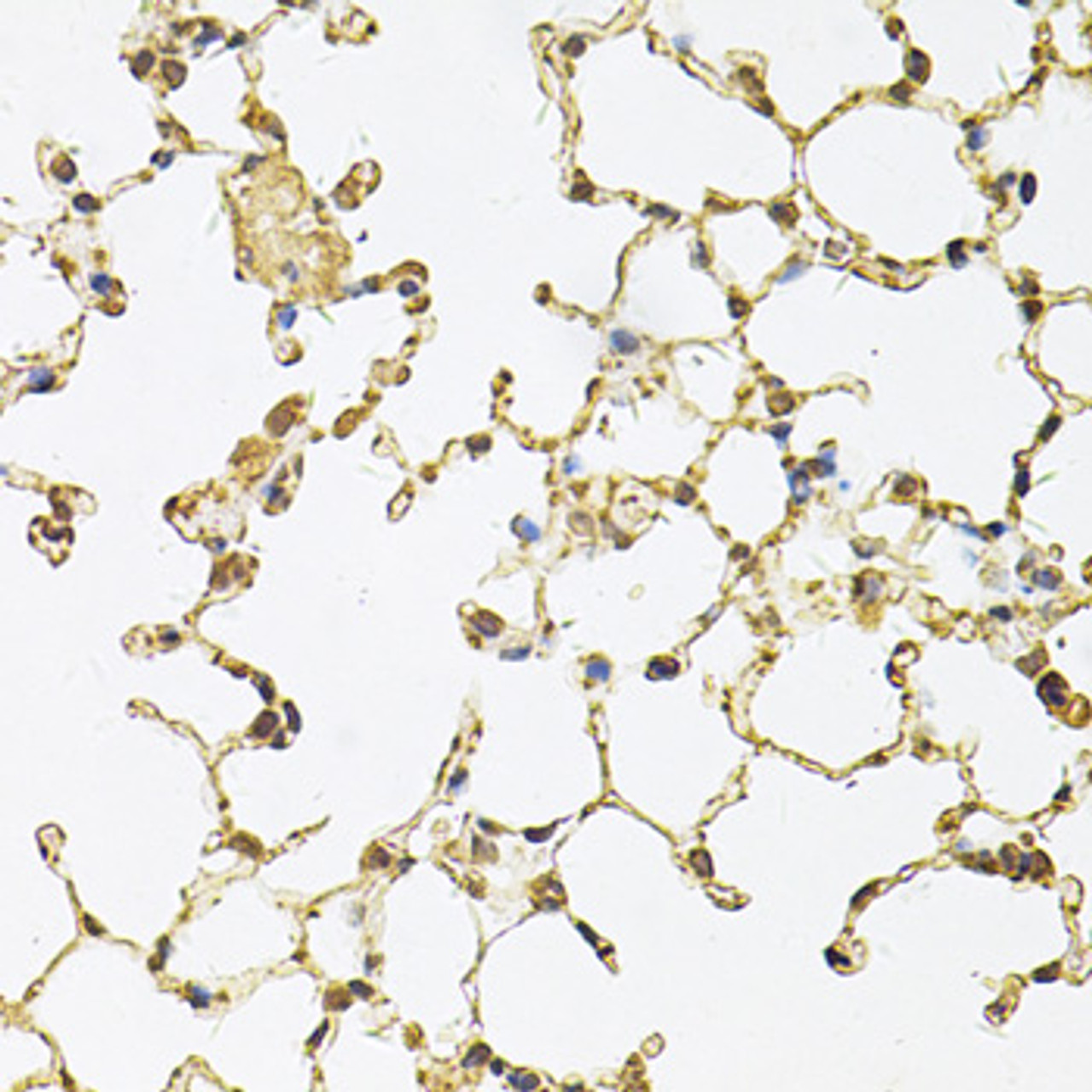 Immunohistochemistry of paraffin-embedded Mouse lung using PSMA5 Polyclonal Antibody at dilution of  1:100 (40x lens).