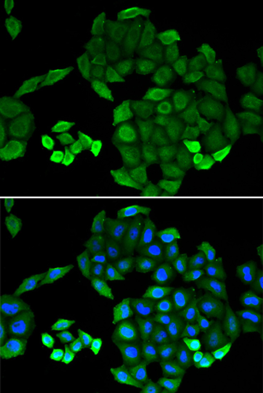 Immunofluorescence analysis of MCF-7 cells using PTS Polyclonal Antibody