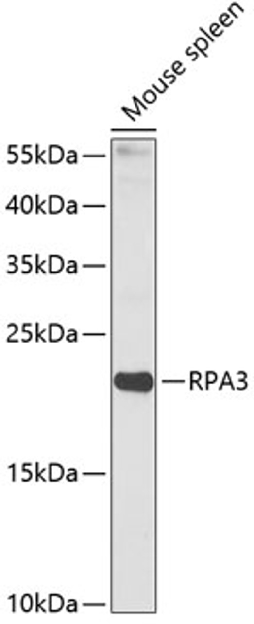 Western blot analysis of extracts of Mouse spleen using RPA3 Polyclonal Antibody at dilution of 1:1000.