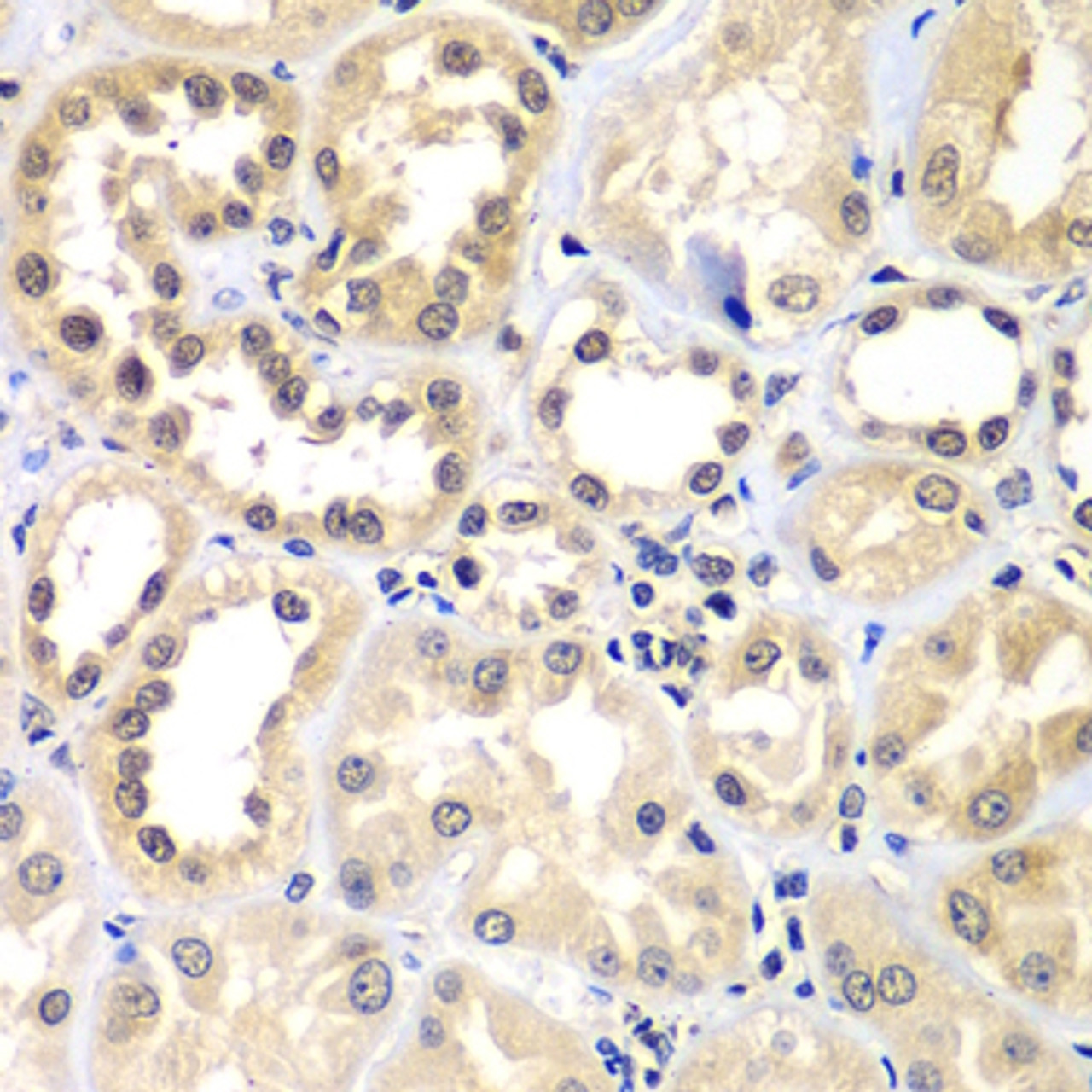 Immunohistochemistry of paraffin-embedded Human kidney using ZNF264 Polyclonal Antibody at dilution of  1:100 (40x lens).