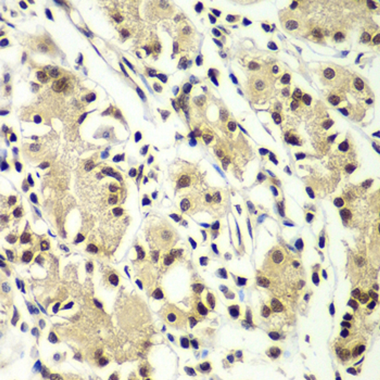 Immunohistochemistry of paraffin-embedded Human gastric using ZNF264 Polyclonal Antibody at dilution of  1:100 (40x lens).