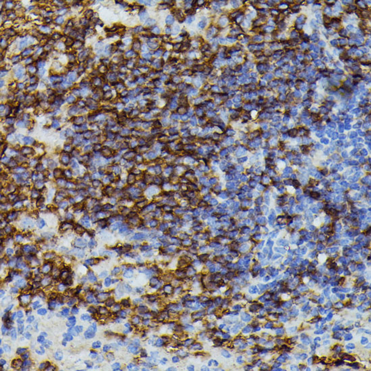 Immunohistochemistry of paraffin-embedded Mouse spleen using APOC3 Polyclonal Antibody at dilution of  1:100 (40x lens).