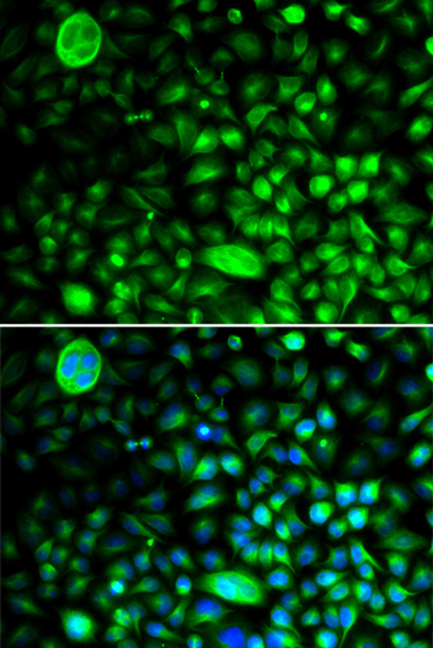 Immunofluorescence analysis of HeLa cells using CACNG2 Polyclonal Antibody