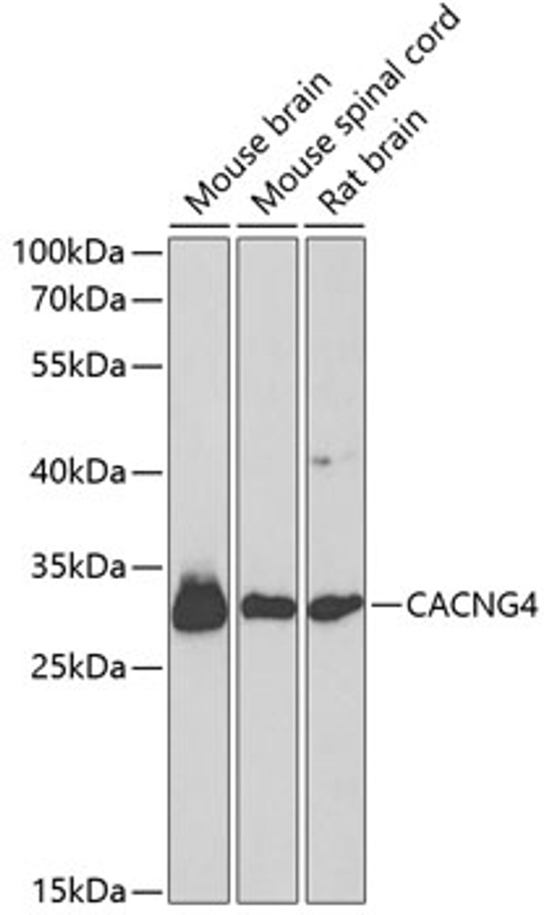 Western blot analysis of extracts of various cell lines using CACNG4 Polyclonal Antibody at dilution of 1:1000.