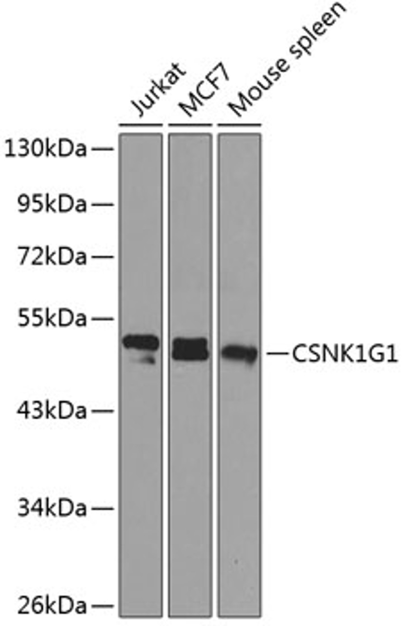 Western blot analysis of extracts of various cell lines using CSNK1G1 Polyclonal Antibody at dilution of 1:1000.