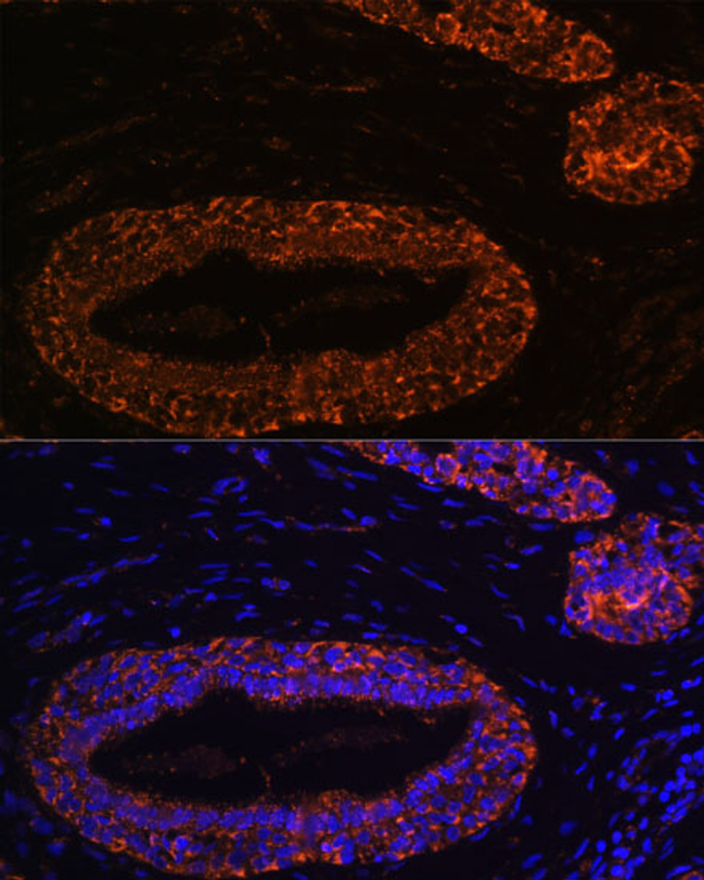 Immunofluorescence analysis of Human breast using RNF31 Polyclonal Antibody at dilution of  1:100 (40x lens). Blue: DAPI for nuclear staining.