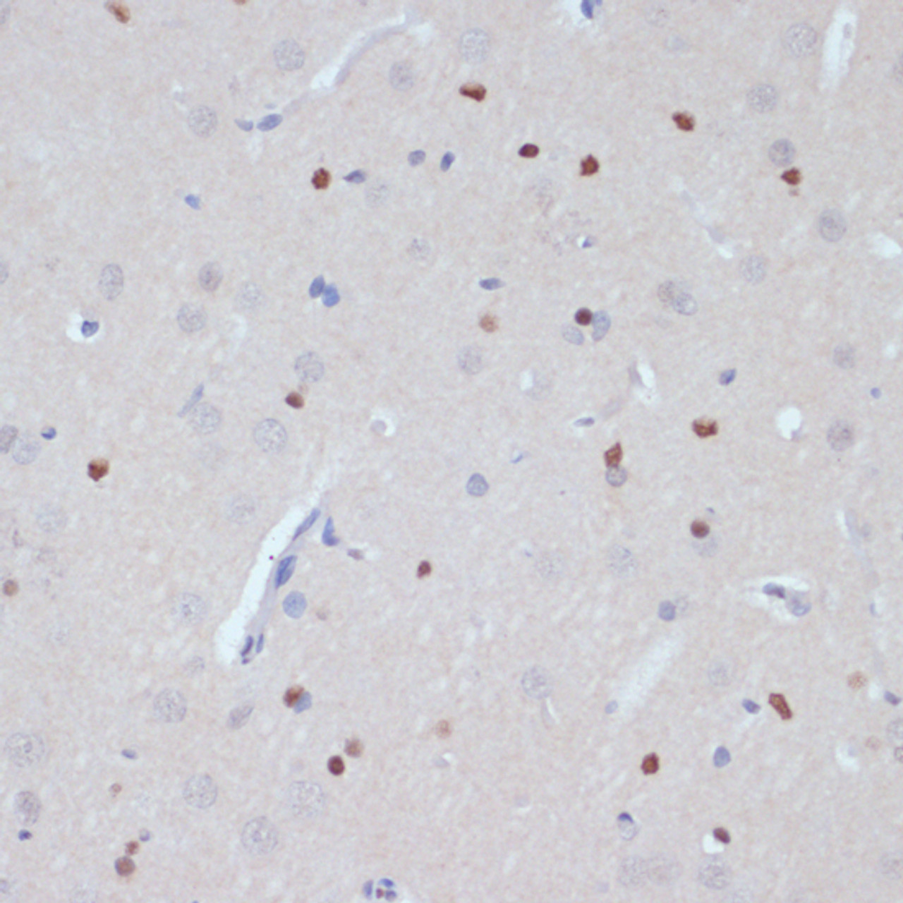 Immunohistochemistry of paraffin-embedded Rat brain using ESRRA Polyclonal Antibody at dilution of  1:200 (40x lens).