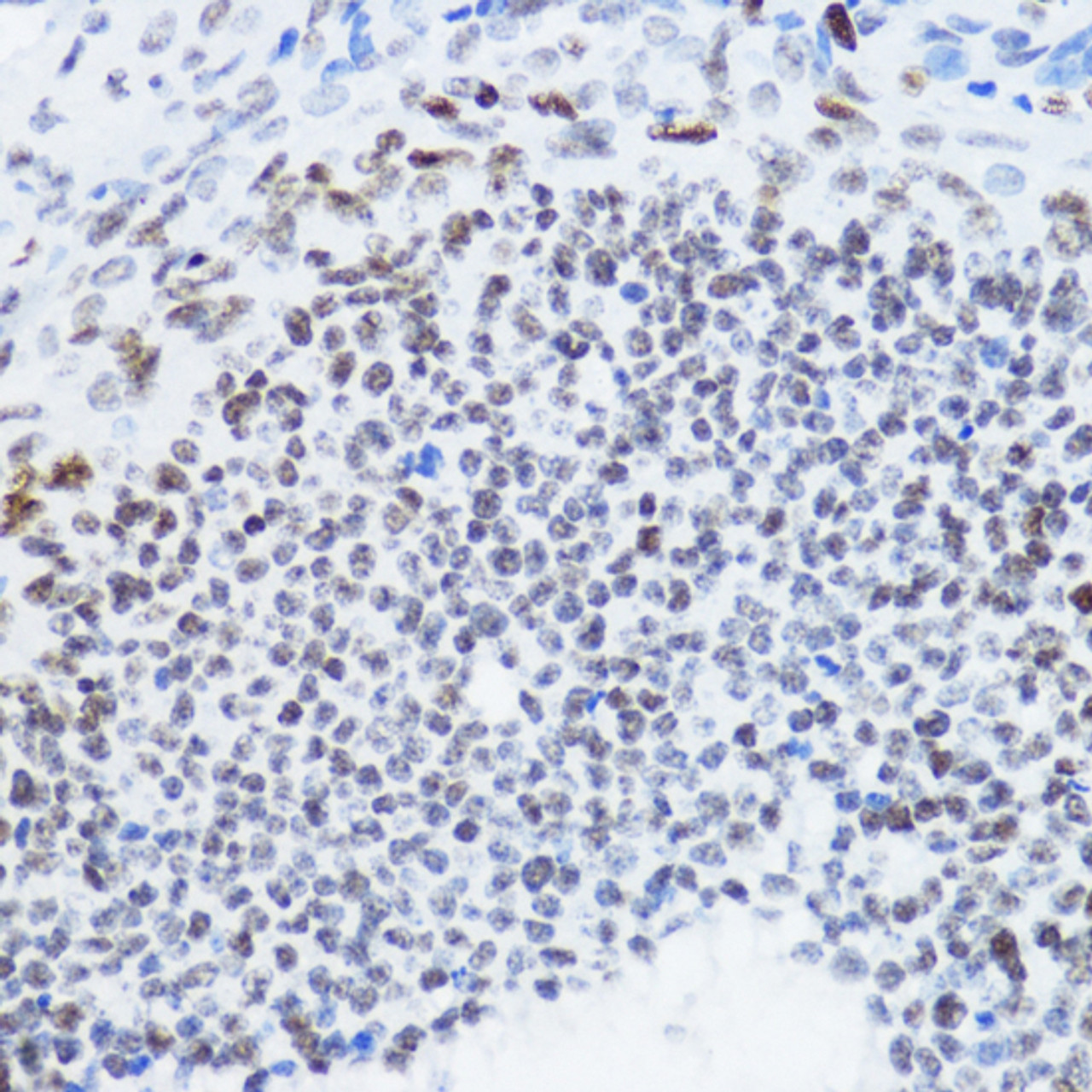 Immunohistochemistry of paraffin-embedded Rat ovary using Acetyl-Histone H4-K12 Polyclonal Antibody at dilution of  1:200 (40x lens).