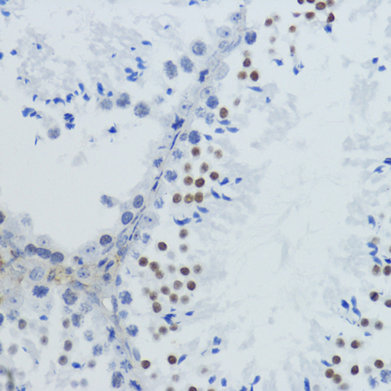 Immunohistochemistry of paraffin-embedded Mouse testis using Acetyl-Histone H4-K12 Polyclonal Antibody at dilution of  1:200 (40x lens).