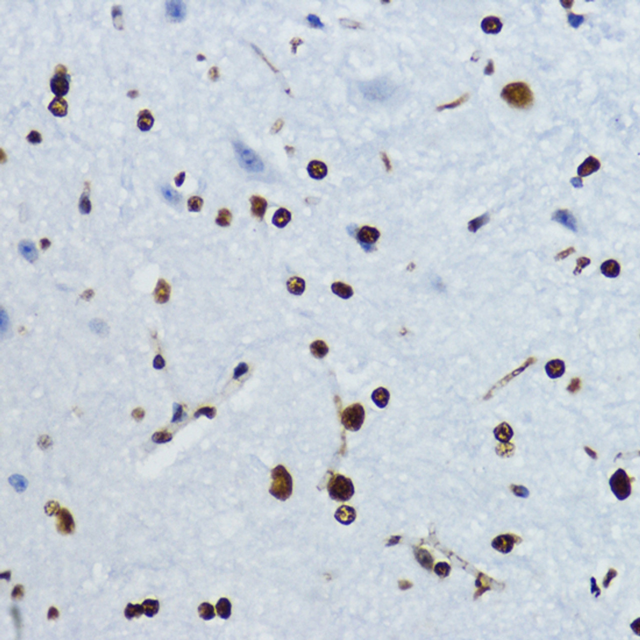 Immunohistochemistry of paraffin-embedded Mouse spinal cord using Acetyl-Histone H4-K12 Polyclonal Antibody at dilution of  1:200 (40x lens).