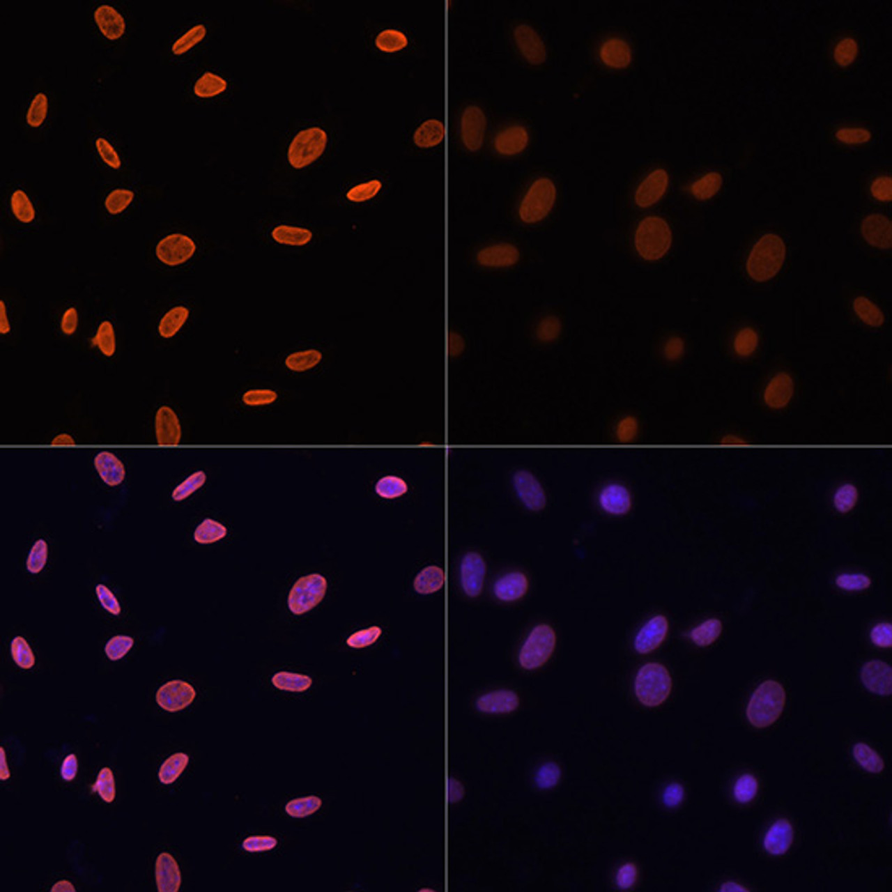 Immunofluorescence analysis of NIH/3T3 cells using Acetyl-Histone H4-K12 Polyclonal Antibody at dilution of  1:100.NIH/3T3 cells were treated by TSA (1 uM) at 37℃ for 18 hours. Blue: DAPI for nuclear staining.