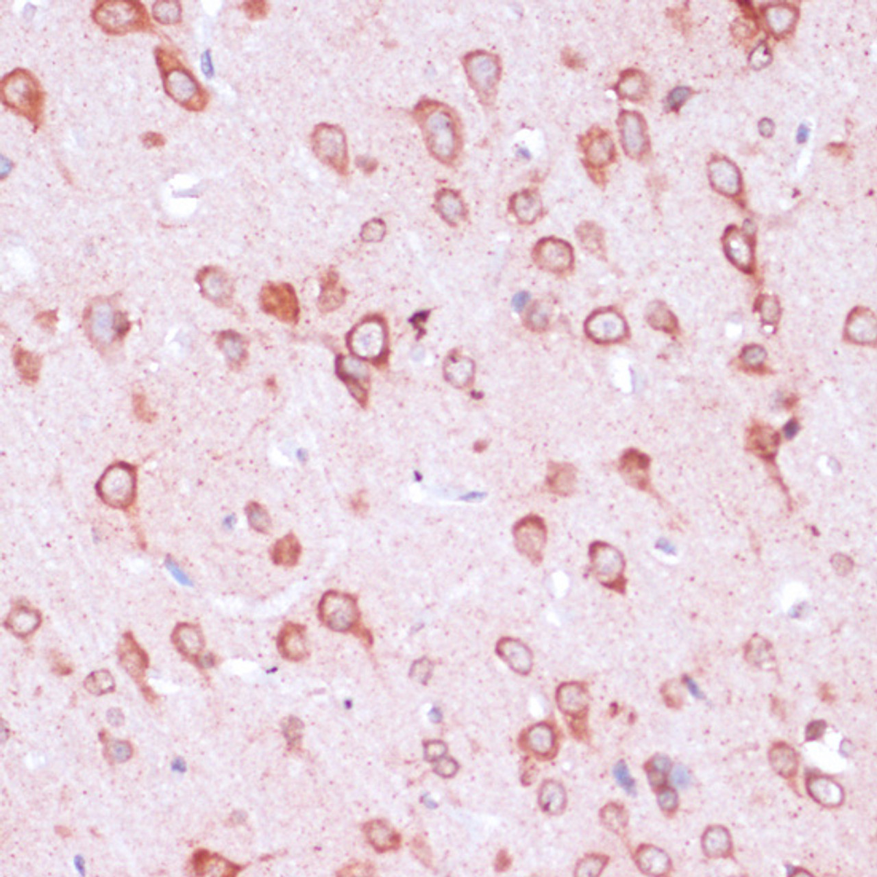 Immunohistochemistry of paraffin-embedded Rat brain using RPL21 Polyclonal Antibody at dilution of  1:100 (40x lens).
