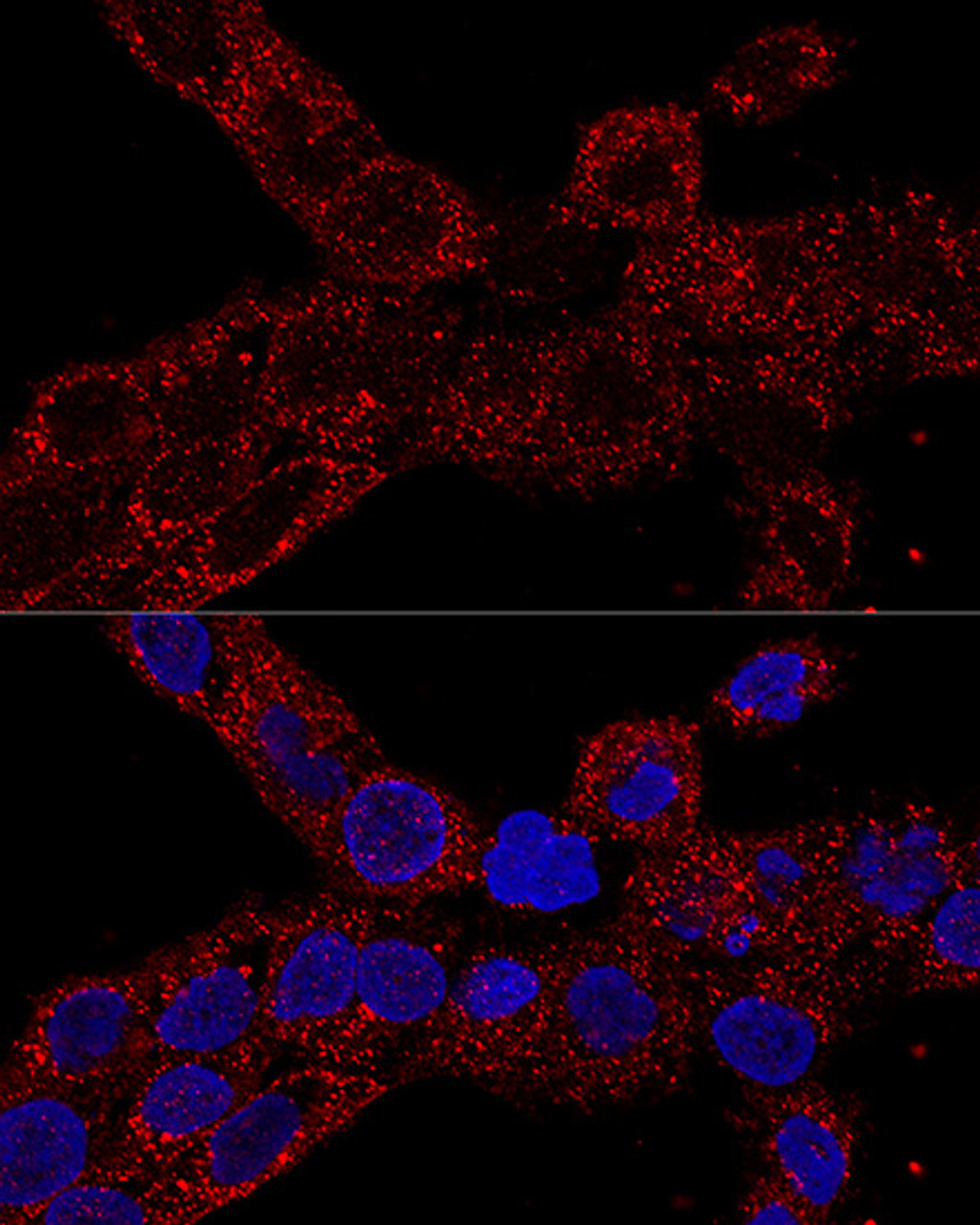 Confocal immunofluorescence analysis of A-431 cells using RPL21 Polyclonal Antibody at dilution of  1:100. Blue: DAPI for nuclear staining.