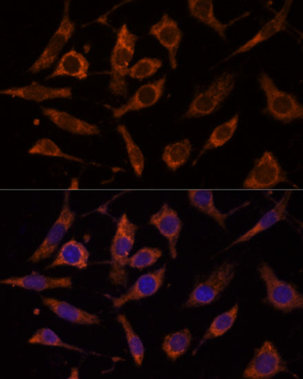 Immunofluorescence analysis of L929 cells using RPL24 Polyclonal Antibody at dilution of  1:100 (40x lens). Blue: DAPI for nuclear staining.