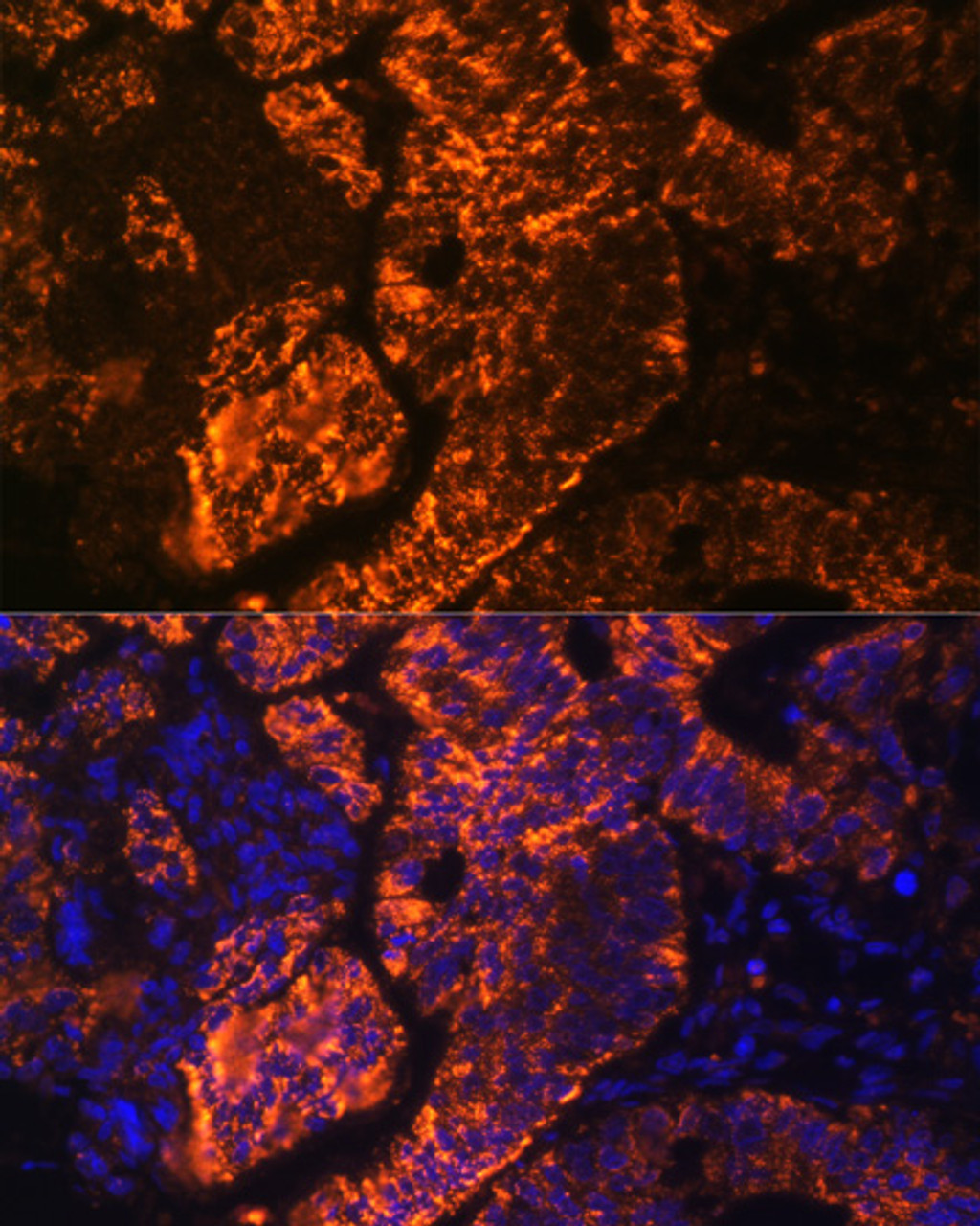 Immunofluorescence analysis of Human colon carcinoma cells using TNFRSF25 Polyclonal Antibody at dilution of  1:100. Blue: DAPI for nuclear staining.