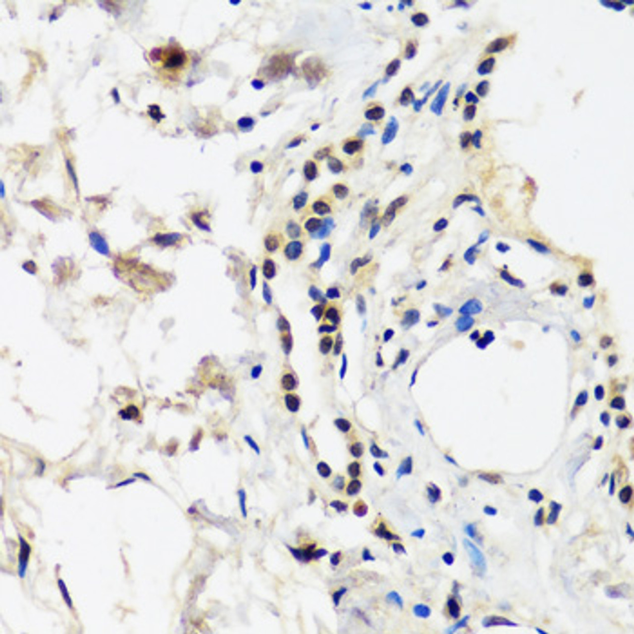 Immunohistochemistry of paraffin-embedded Human lung using CAND1 Polyclonal Antibody at dilution of  1:100 (40x lens).