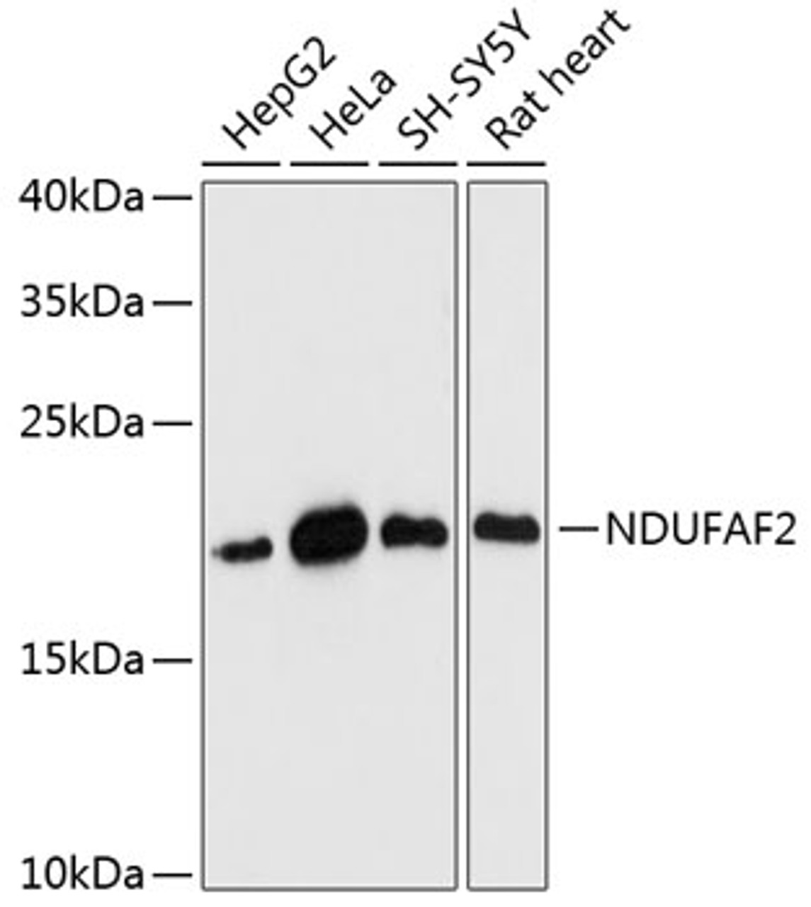 Western blot analysis of extracts of various cell lines using NDUFAF2 Polyclonal Antibody at dilution of 1:3000.