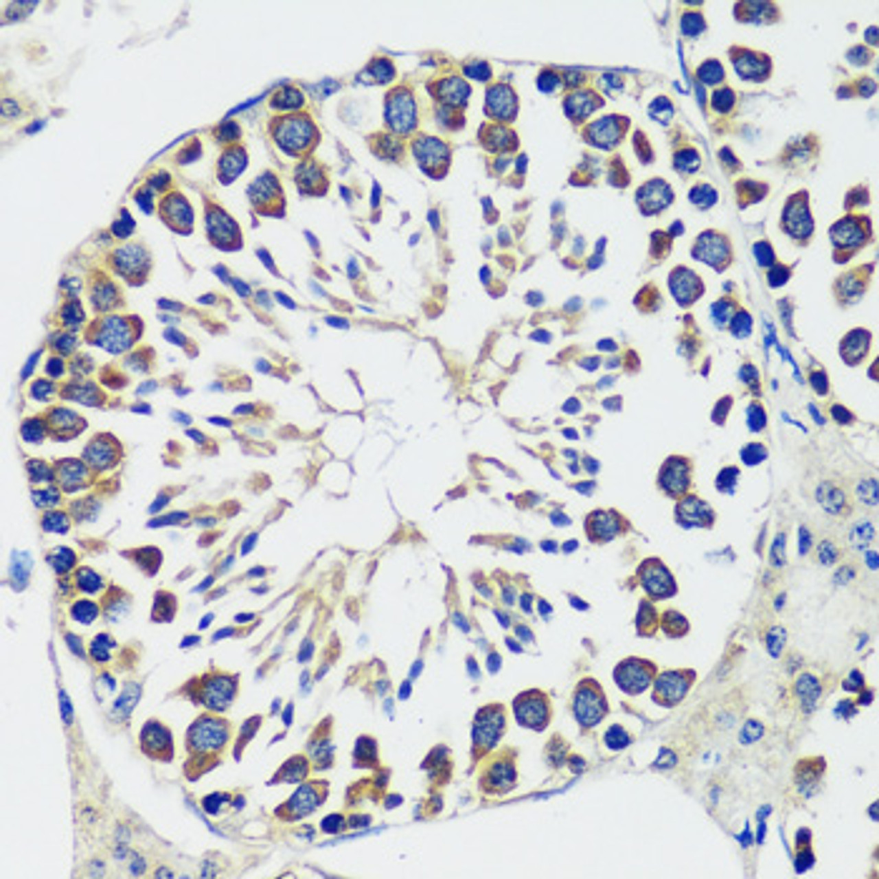 Immunohistochemistry of paraffin-embedded Mouse testis using CCDC124 Polyclonal Antibody at dilution of  1:100 (40x lens).