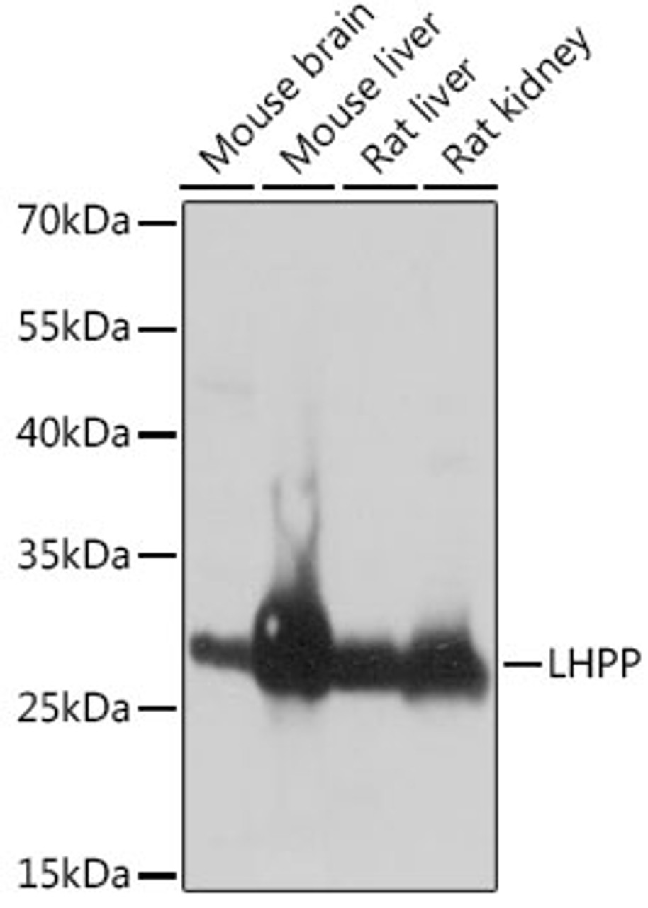 Western blot analysis of extracts of various cell lines using LHPP Polyclonal Antibody at dilution of 1:1000.