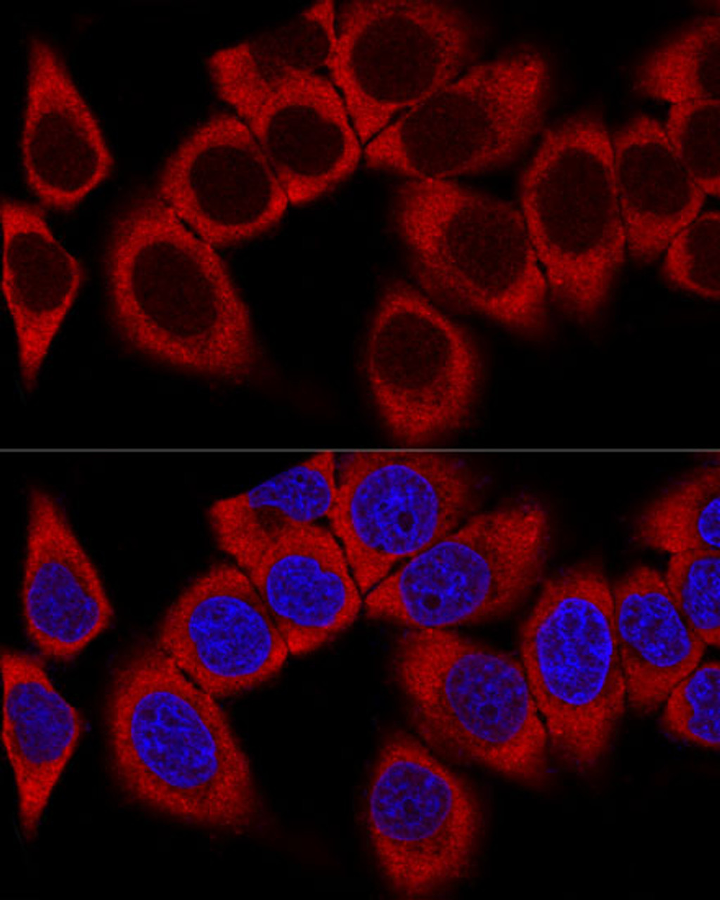 Confocal immunofluorescence analysis of HeLa cells using RPL36AL Polyclonal Antibody at dilution of  1:100. Blue: DAPI for nuclear staining.