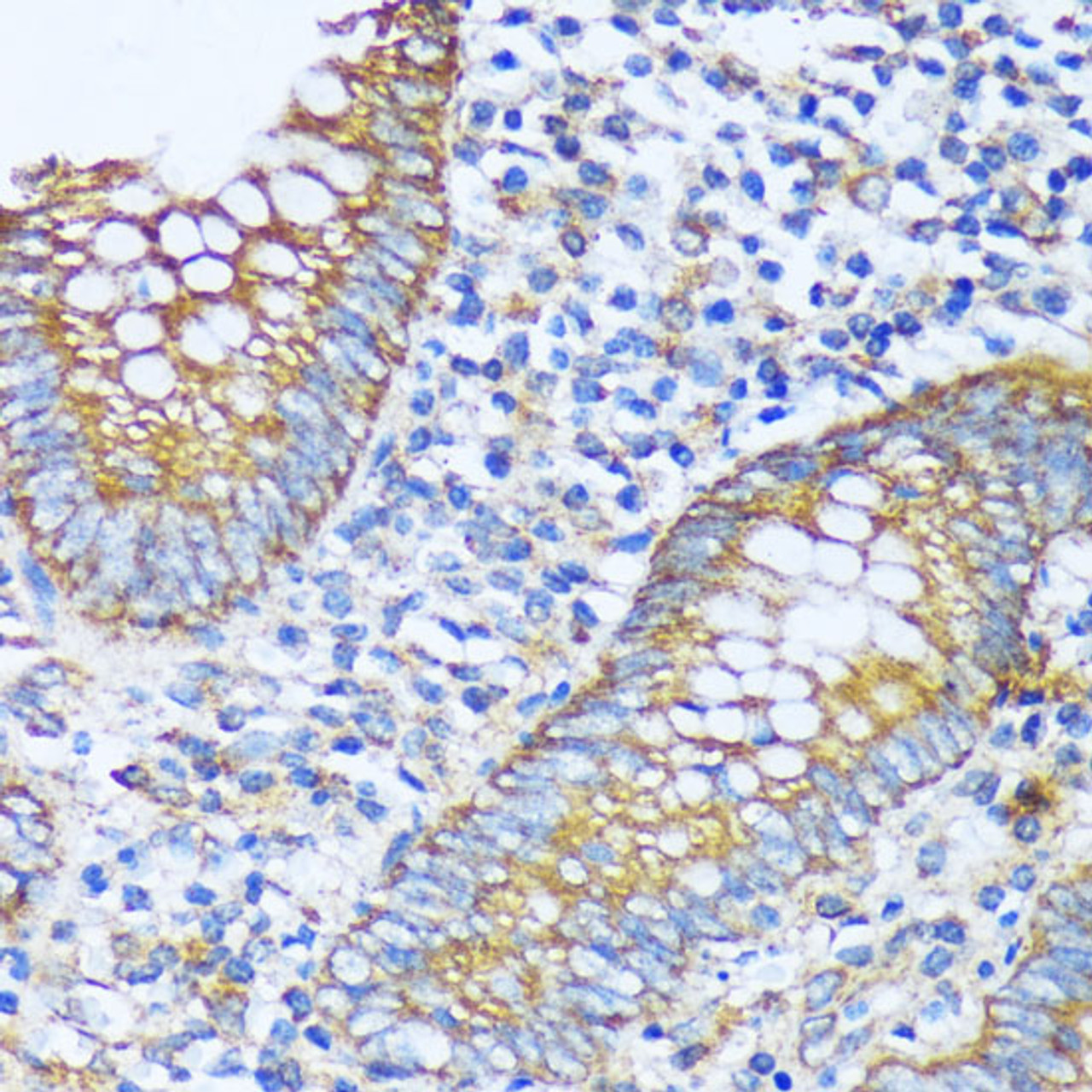 Immunohistochemistry of paraffin-embedded Human appendix using ACOT2 Polyclonal Antibody at dilution of  1:100 (40x lens).