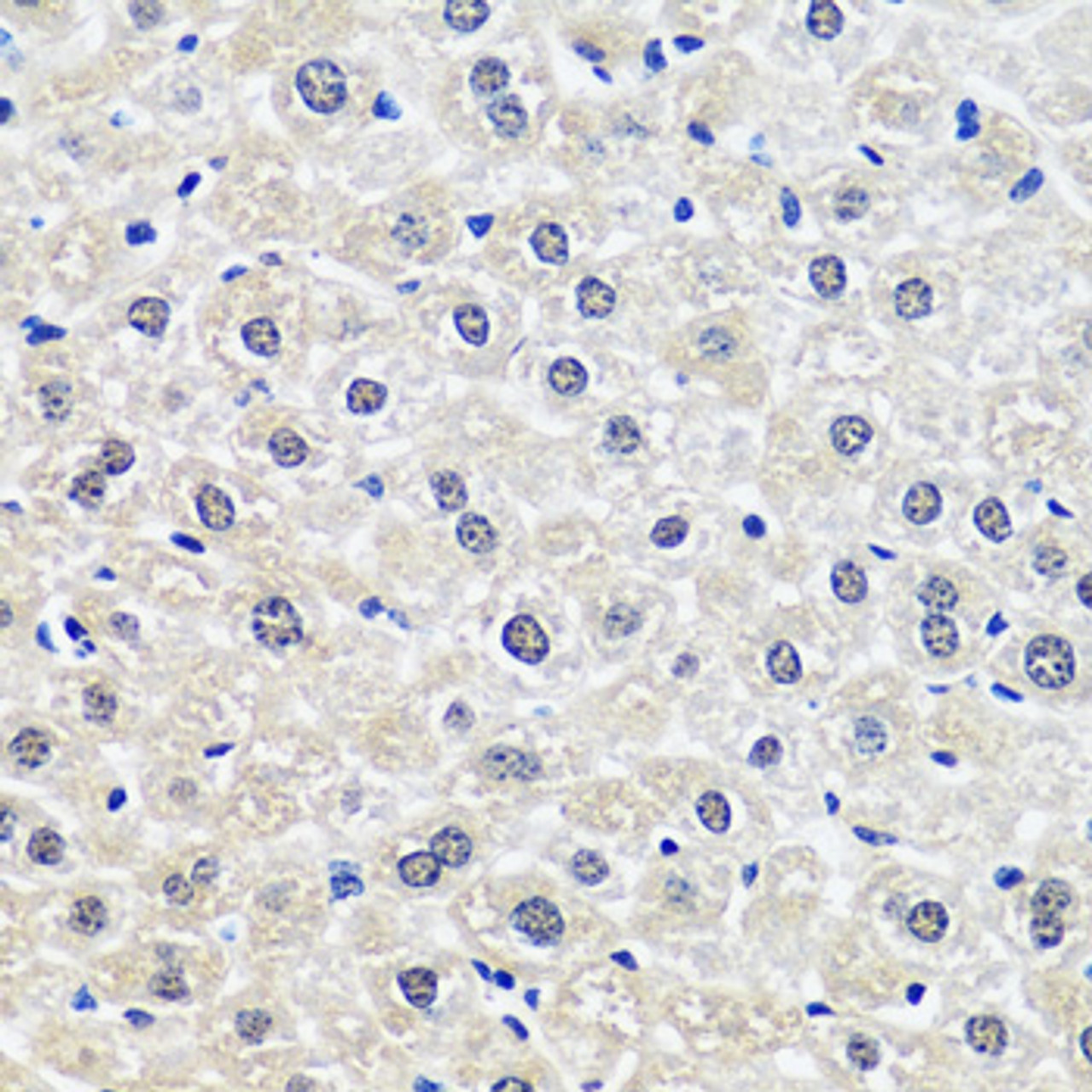 Immunohistochemistry of paraffin-embedded Rat liver using CCDC59 Polyclonal Antibody at dilution of  1:100 (40x lens).