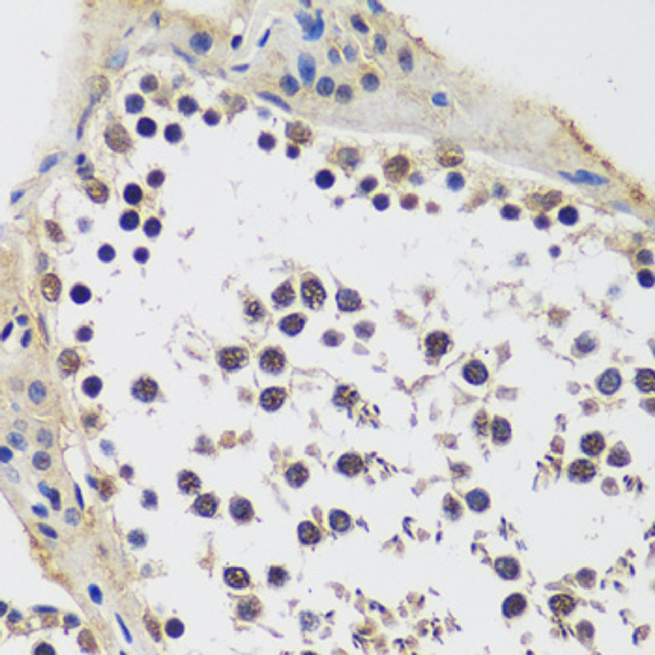 Immunohistochemistry of paraffin-embedded Rat testis using CCDC59 Polyclonal Antibody at dilution of  1:100 (40x lens).