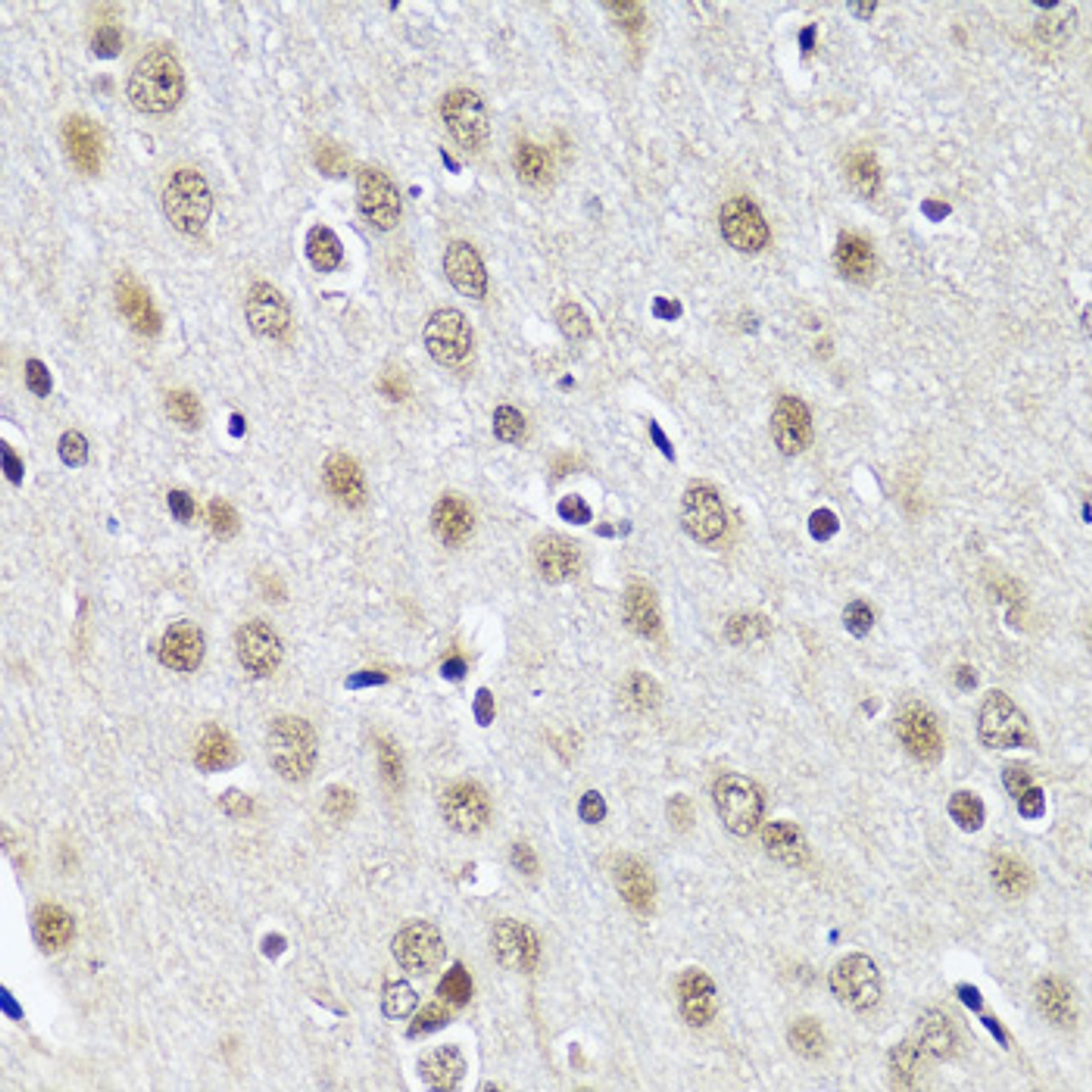 Immunohistochemistry of paraffin-embedded Rat brain using CCDC59 Polyclonal Antibody at dilution of  1:100 (40x lens).