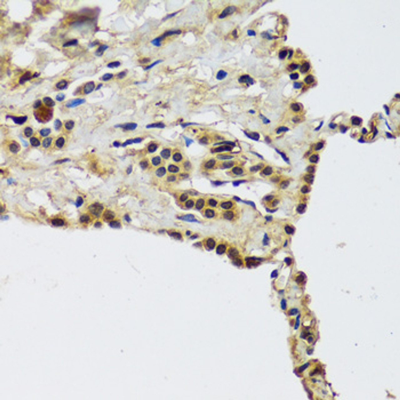 Immunohistochemistry of paraffin-embedded Human lung using CCDC59 Polyclonal Antibody at dilution of  1:100 (40x lens).