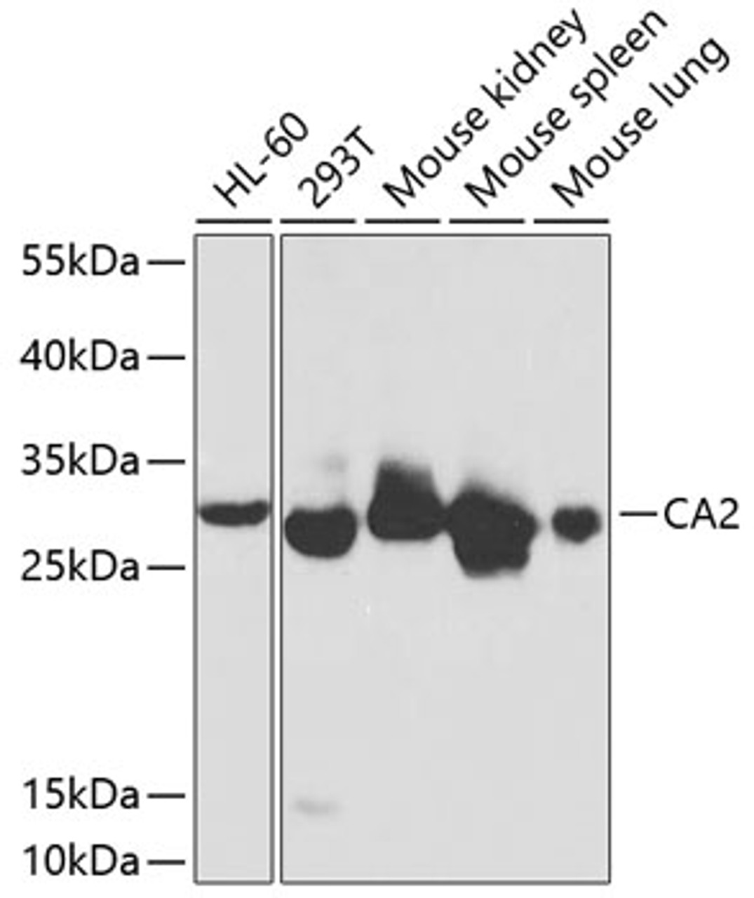 Western blot analysis of extracts of various cell lines using CA2 Polyclonal Antibody at dilution of 1:1000.