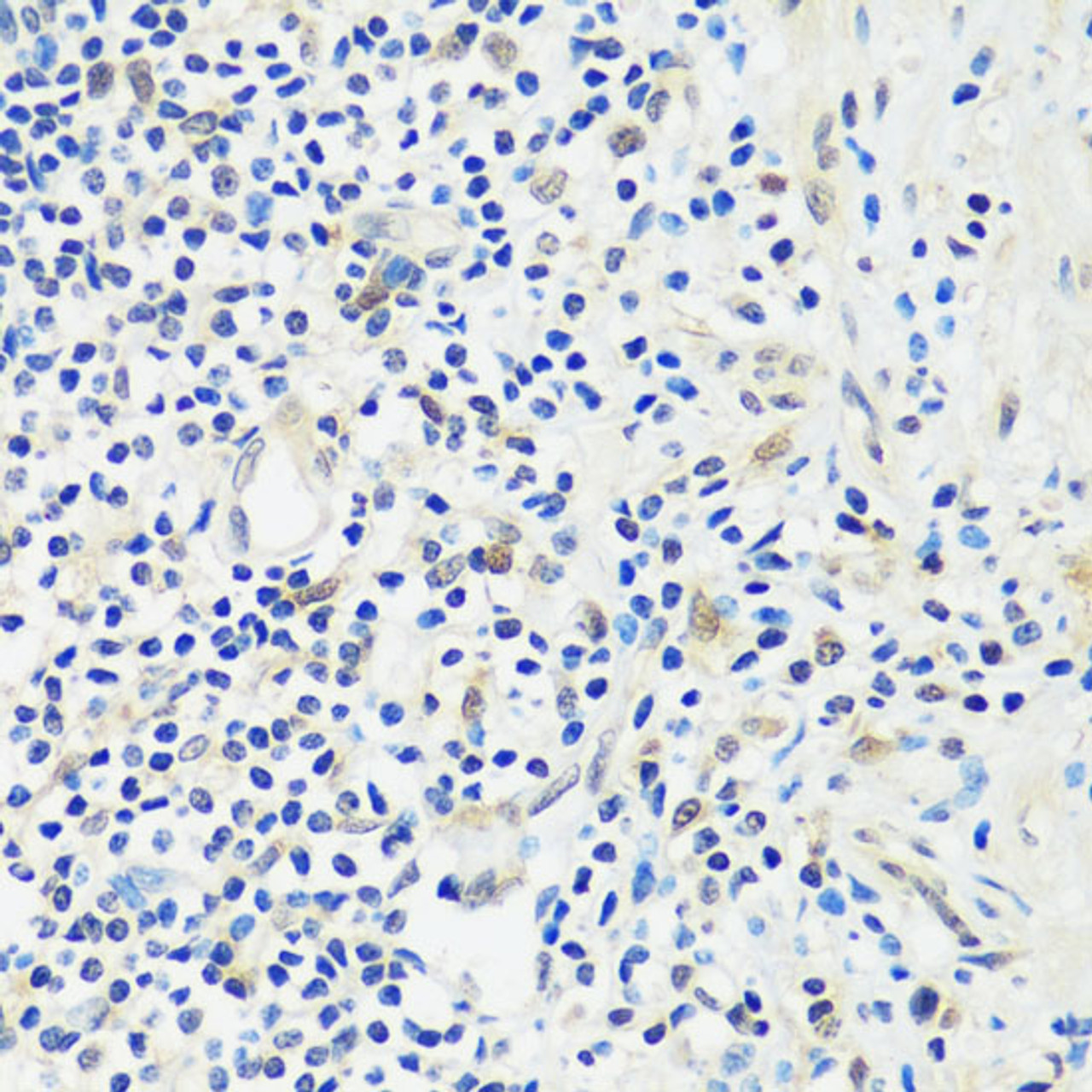 Immunohistochemistry of paraffin-embedded Human appendix using ASCL4 Polyclonal Antibody at dilution of  1:100 (40x lens).