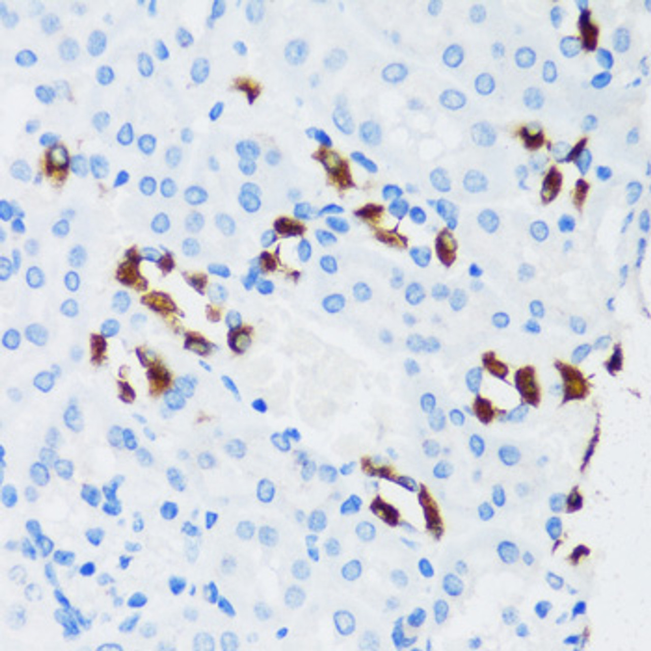 Immunohistochemistry of paraffin-embedded Mouse kidney using ATP6V1G3 Polyclonal Antibody at dilution of  1:100 (40x lens).