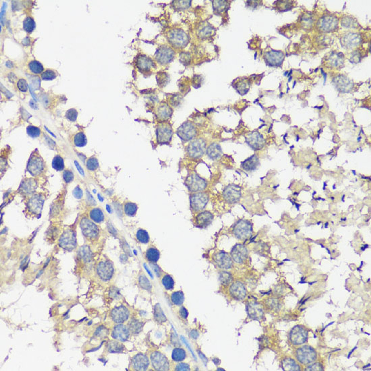 Immunohistochemistry of paraffin-embedded Rat testis using ASZ1 Polyclonal Antibody at dilution of  1:100 (40x lens).