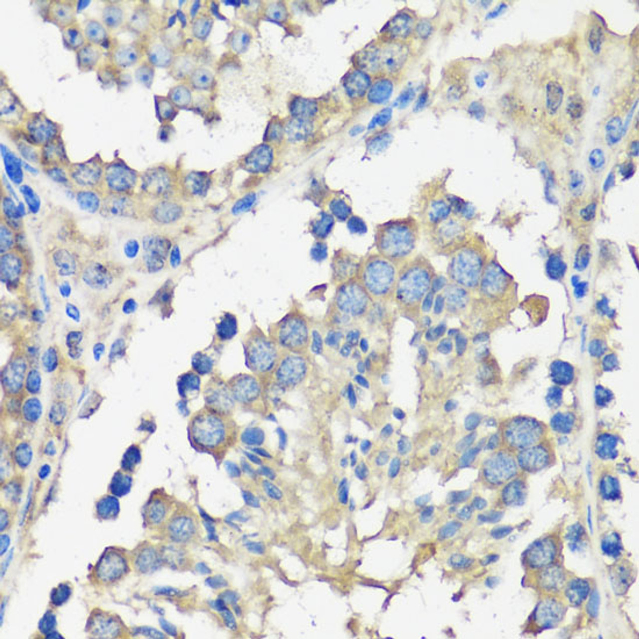 Immunohistochemistry of paraffin-embedded Mouse testis using ASZ1 Polyclonal Antibody at dilution of  1:100 (40x lens).