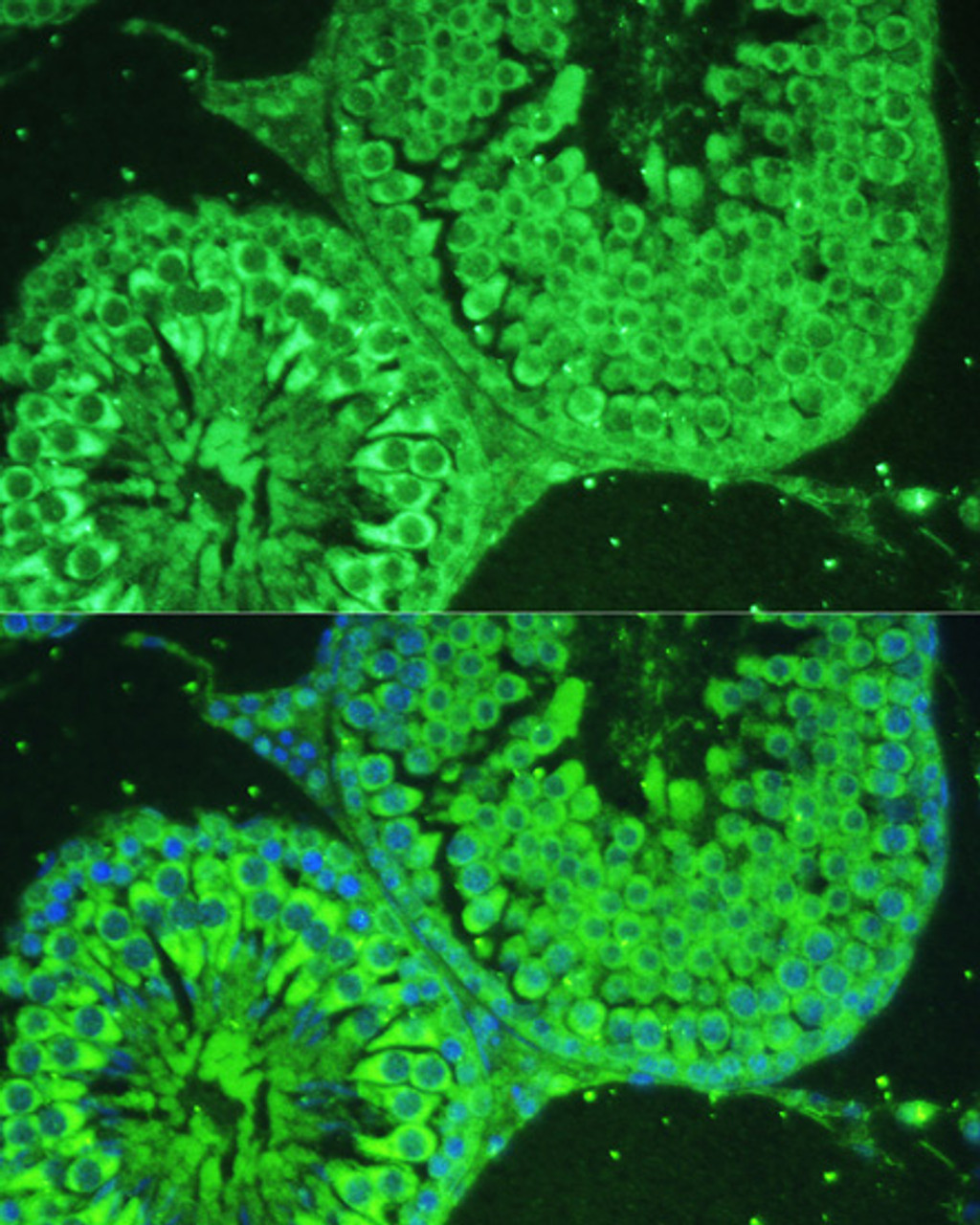 Immunofluorescence analysis of Rat testis cells using ASZ1 Polyclonal Antibody at dilution of  1:100. Blue: DAPI for nuclear staining.