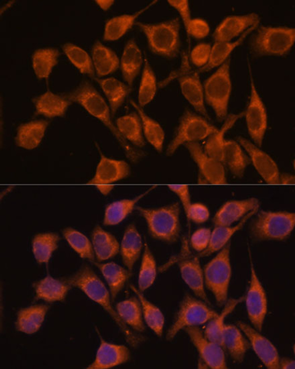 Immunofluorescence analysis of HeLa cells using UBQLNL Polyclonal Antibody at dilution of  1:100. Blue: DAPI for nuclear staining.
