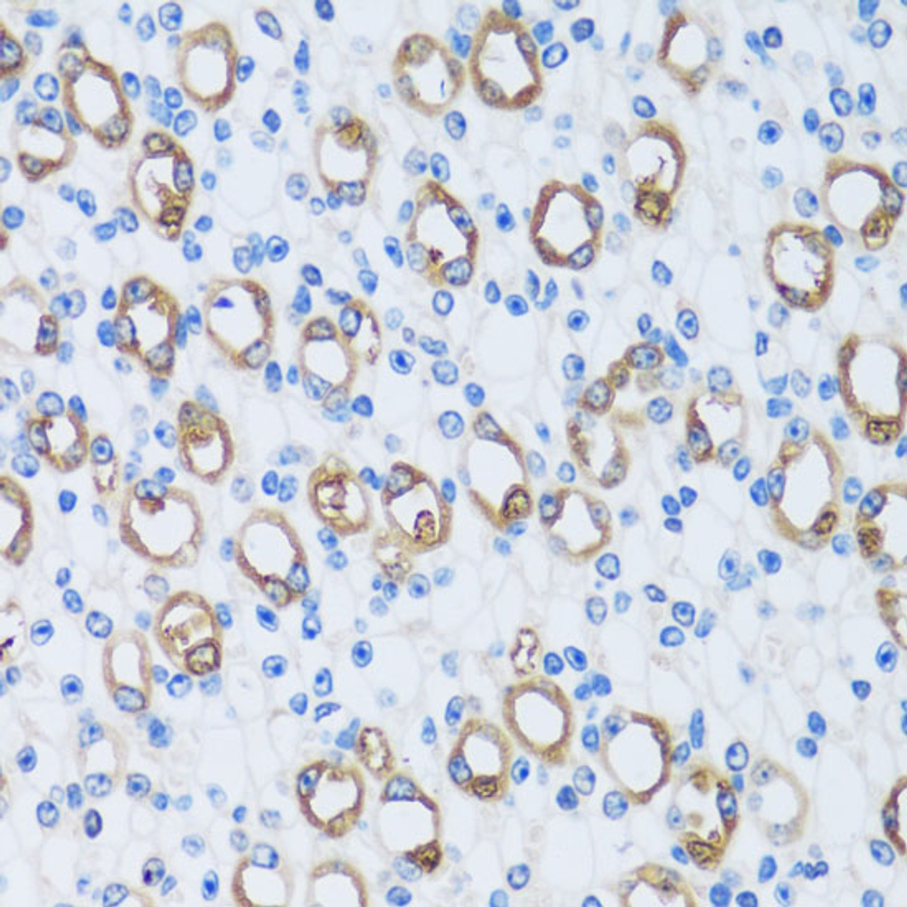 Immunohistochemistry of paraffin-embedded Mouse kidney using CA13 Polyclonal Antibody at dilution of  1:100 (40x lens).