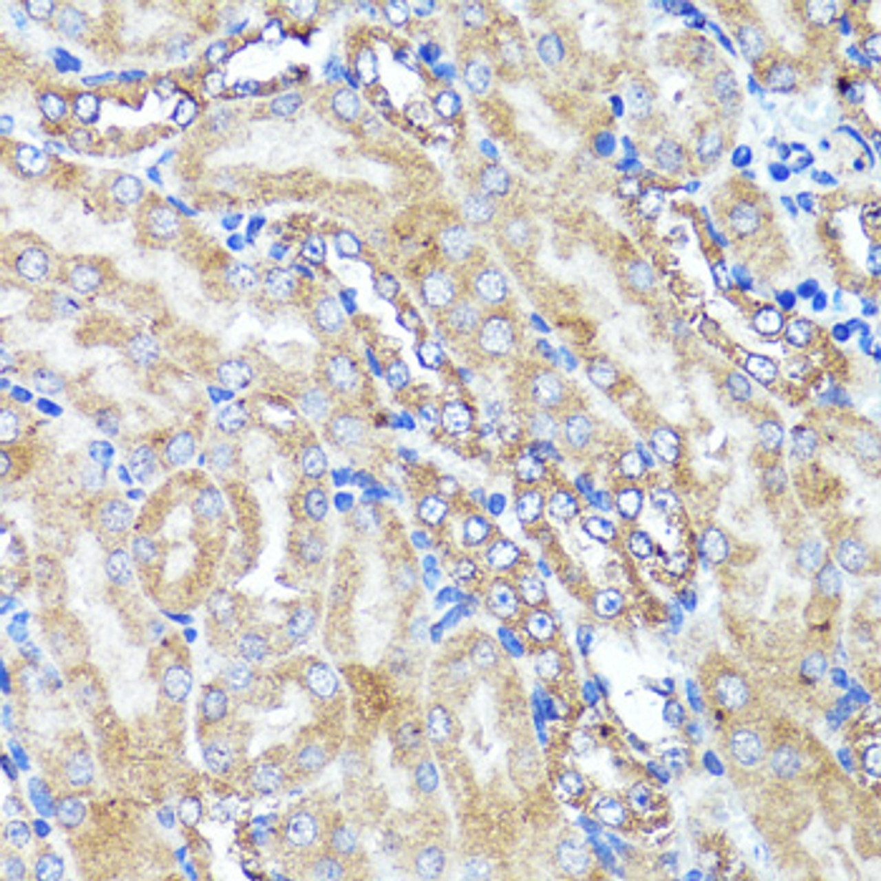 Immunohistochemistry of paraffin-embedded Mouse kidney using CNR1 Polyclonal Antibody at dilution of  1:150 (40x lens).