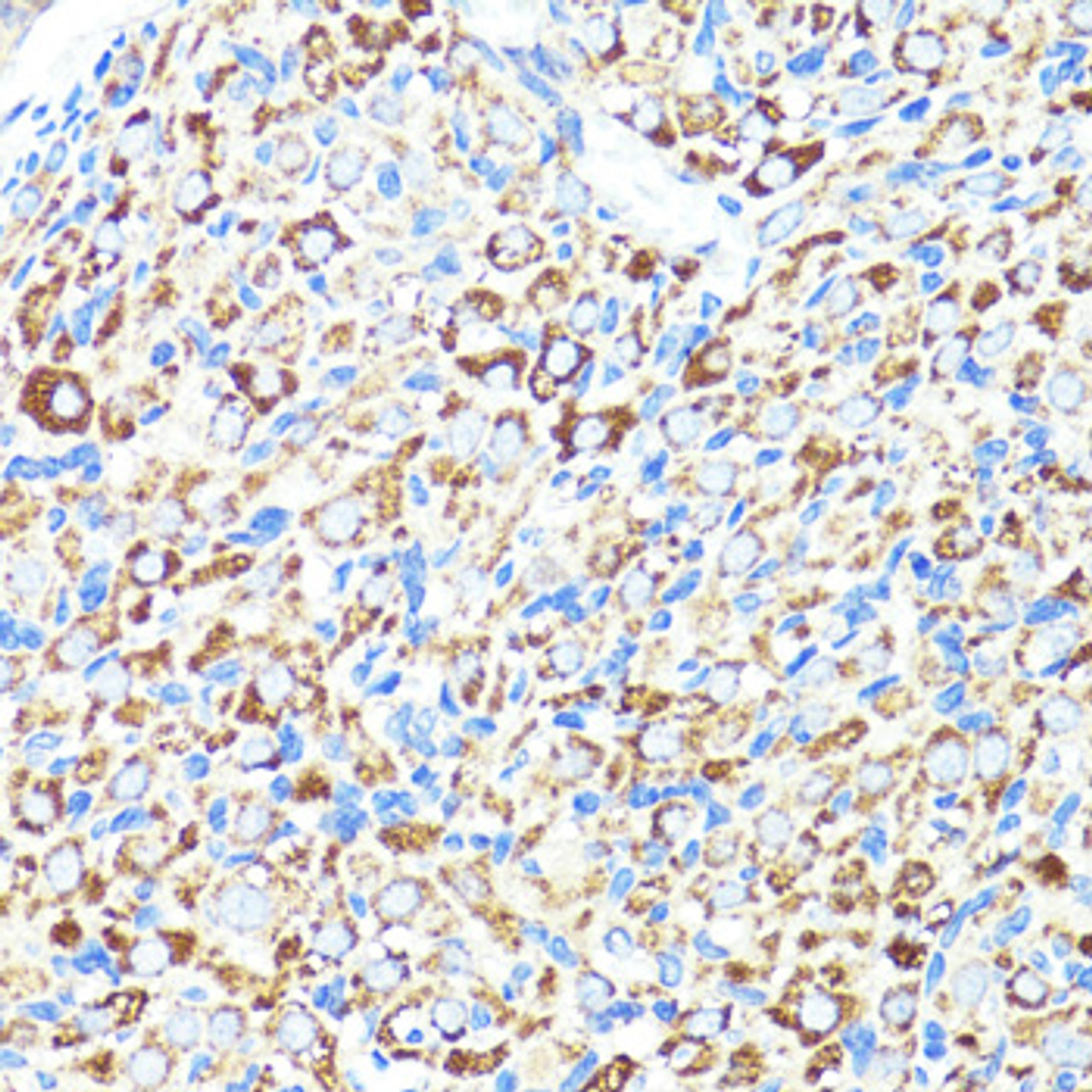 Immunohistochemistry of paraffin-embedded Rat ovary using CNR1 Polyclonal Antibody at dilution of  1:150 (40x lens).