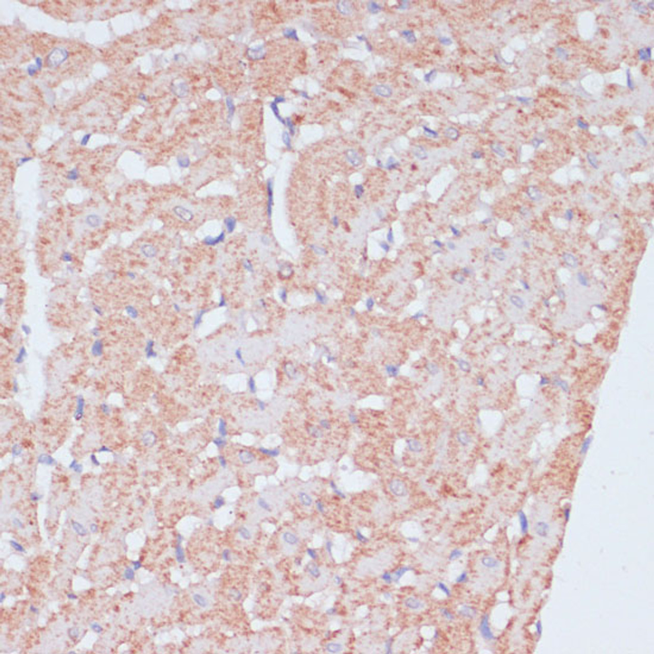 Immunohistochemistry of paraffin-embedded Rat heart using MZB1 Polyclonal Antibody at dilution of  1:100 (40x lens).