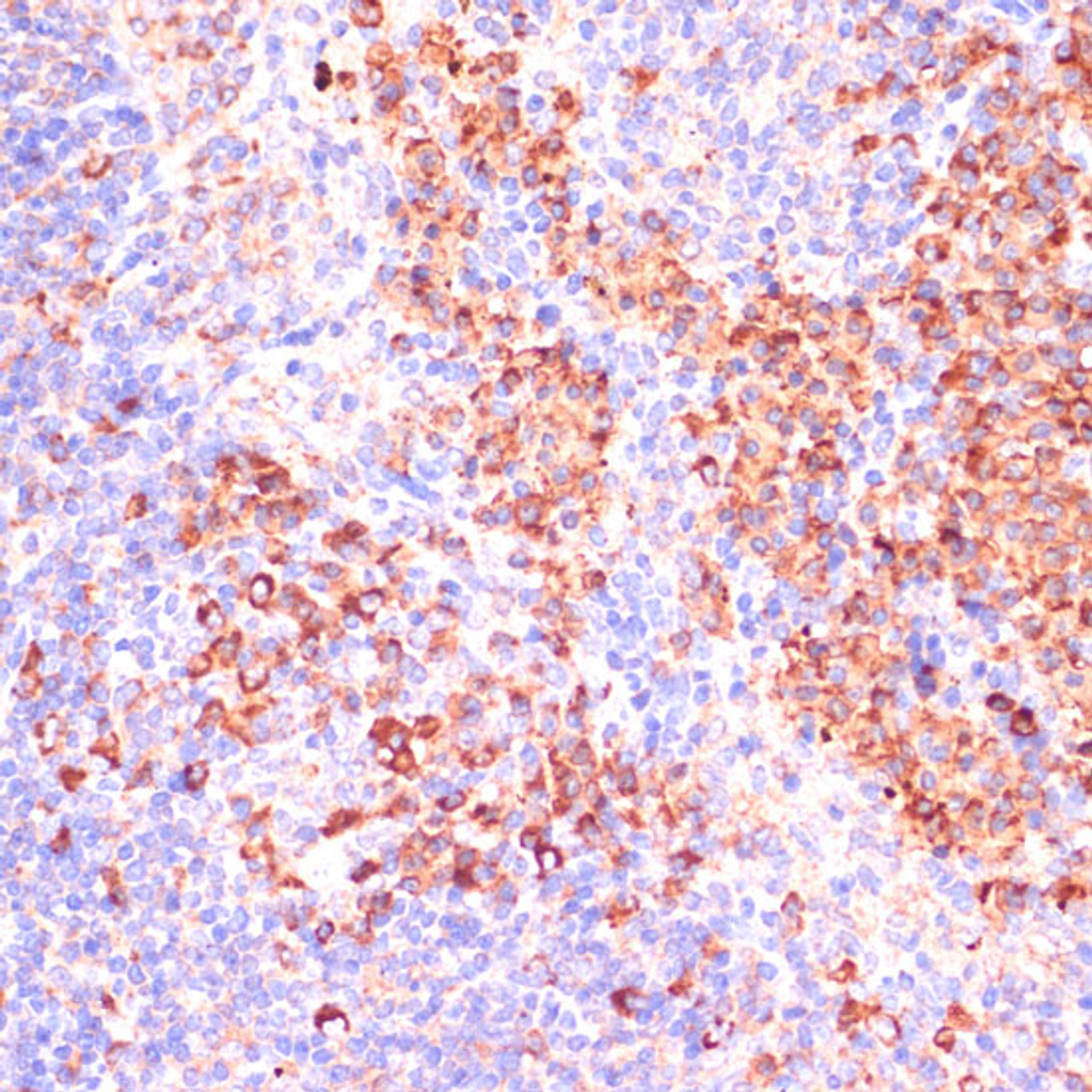 Immunohistochemistry of paraffin-embedded Mouse spleen using MZB1 Polyclonal Antibody at dilution of  1:100 (40x lens).