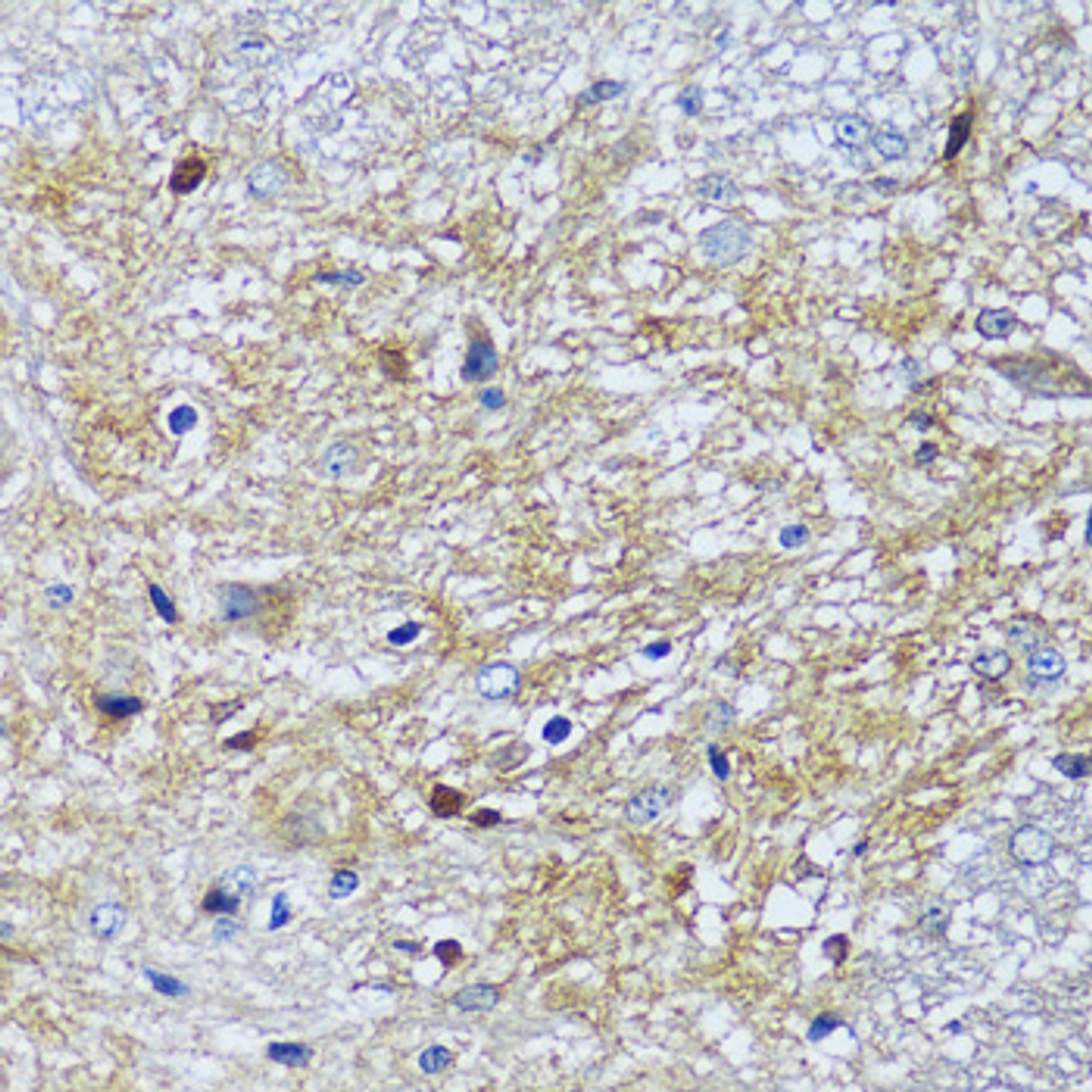 Immunohistochemistry of paraffin-embedded Mouse spinal cord using CAMK1 Polyclonal Antibody at dilution of  1:100 (40x lens).