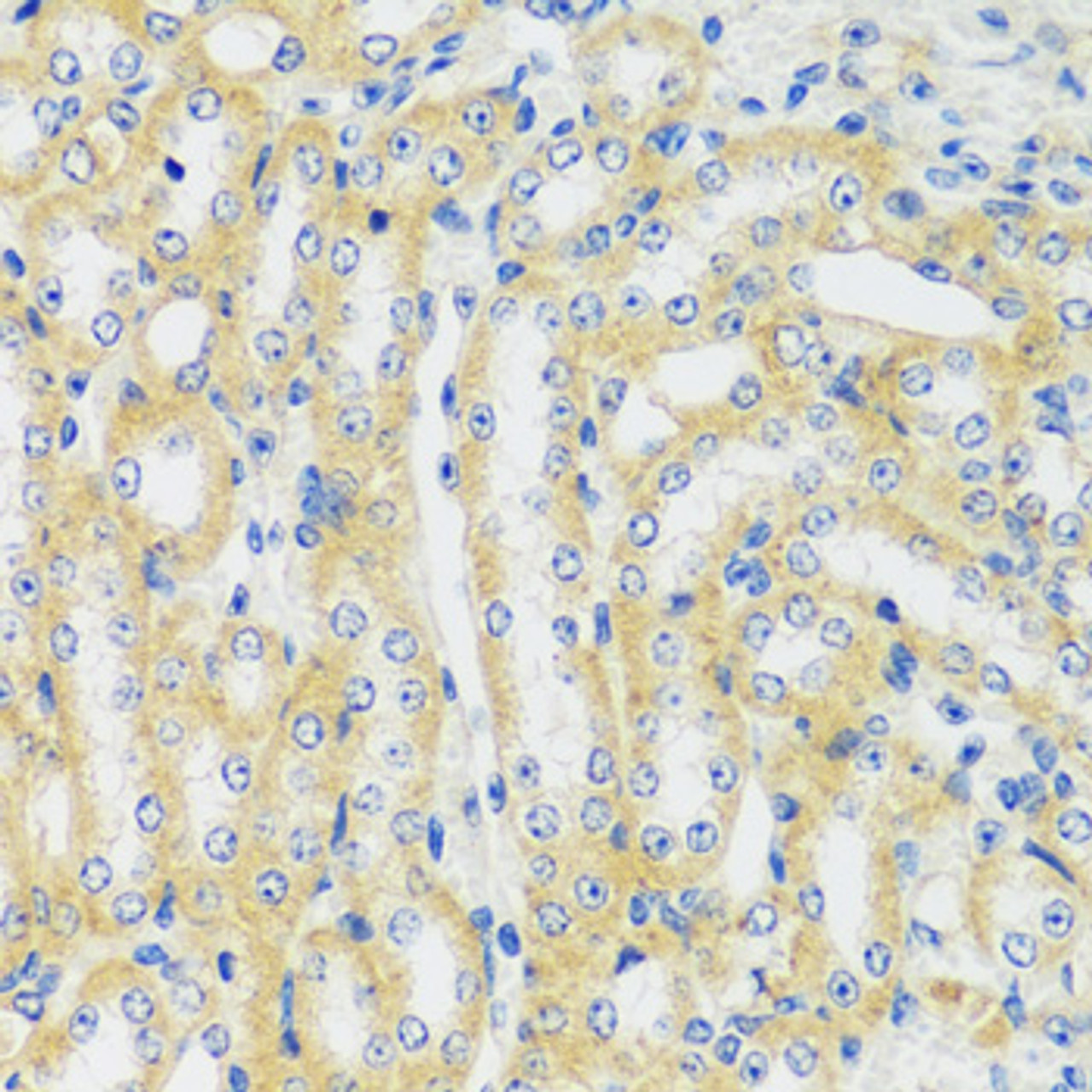 Immunohistochemistry of paraffin-embedded Mouse kidney using CAMK1 Polyclonal Antibody at dilution of  1:100 (40x lens).