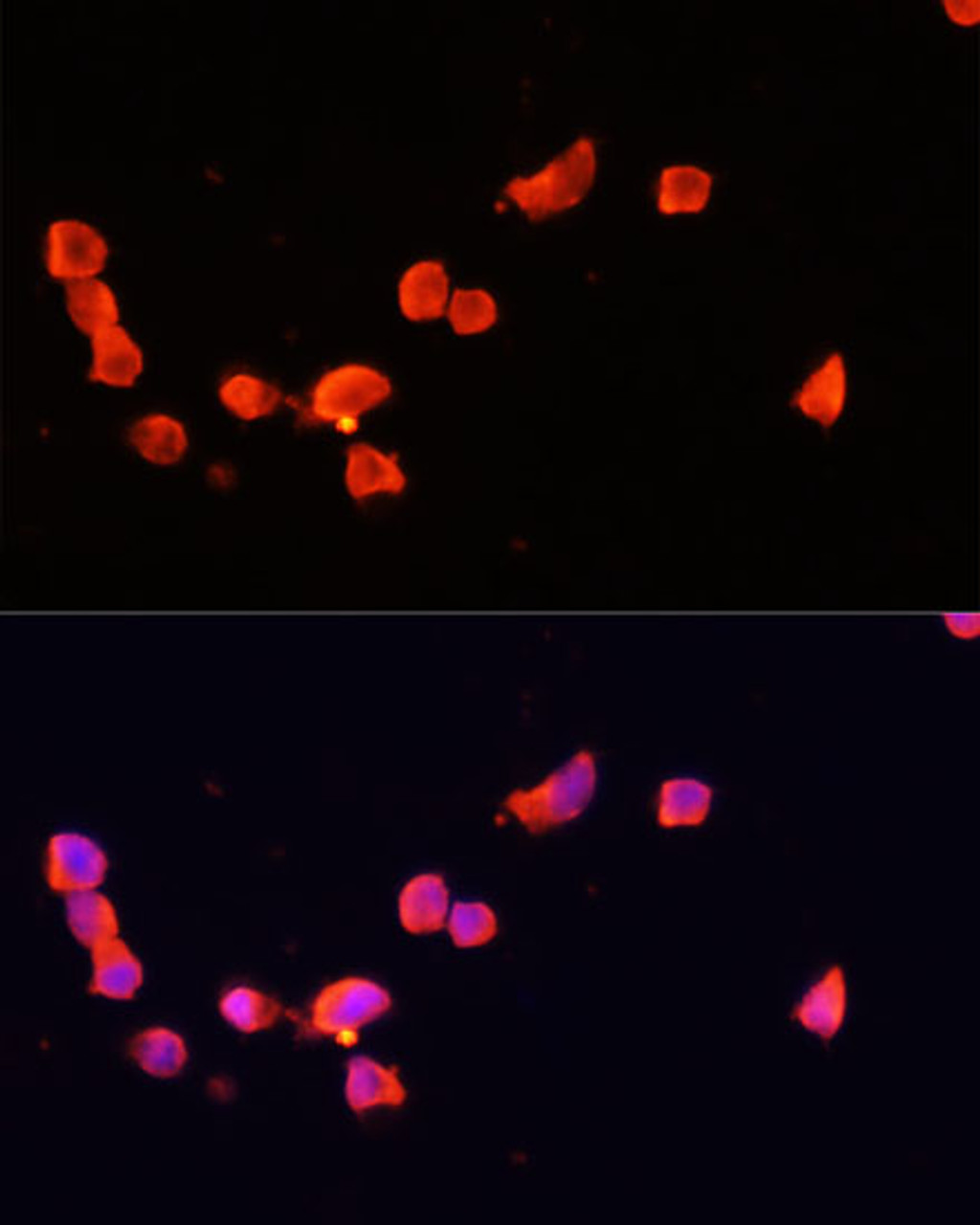 Immunofluorescence analysis of SH-SY5Y cells using CDK5R1 Polyclonal Antibody at dilution of  1:100. Blue: DAPI for nuclear staining.