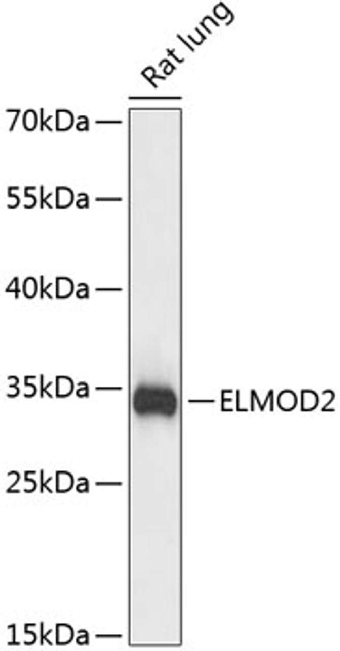 Western blot analysis of extracts of Rat lung using ELMOD2 Polyclonal Antibody at dilution of 1:3000.