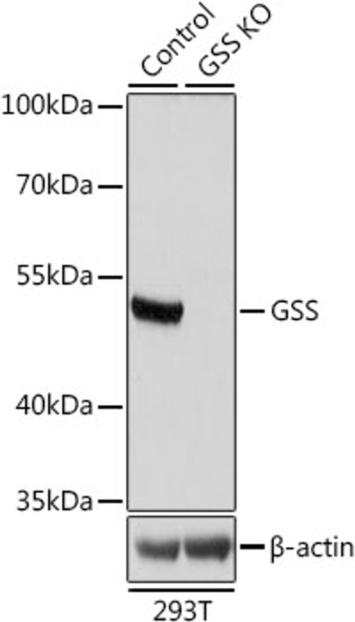 Western blot analysis of extracts from normal (control) and GSS knockout (KO) 293T cells using GSS Polyclonal Antibody at dilution of 1:1000.