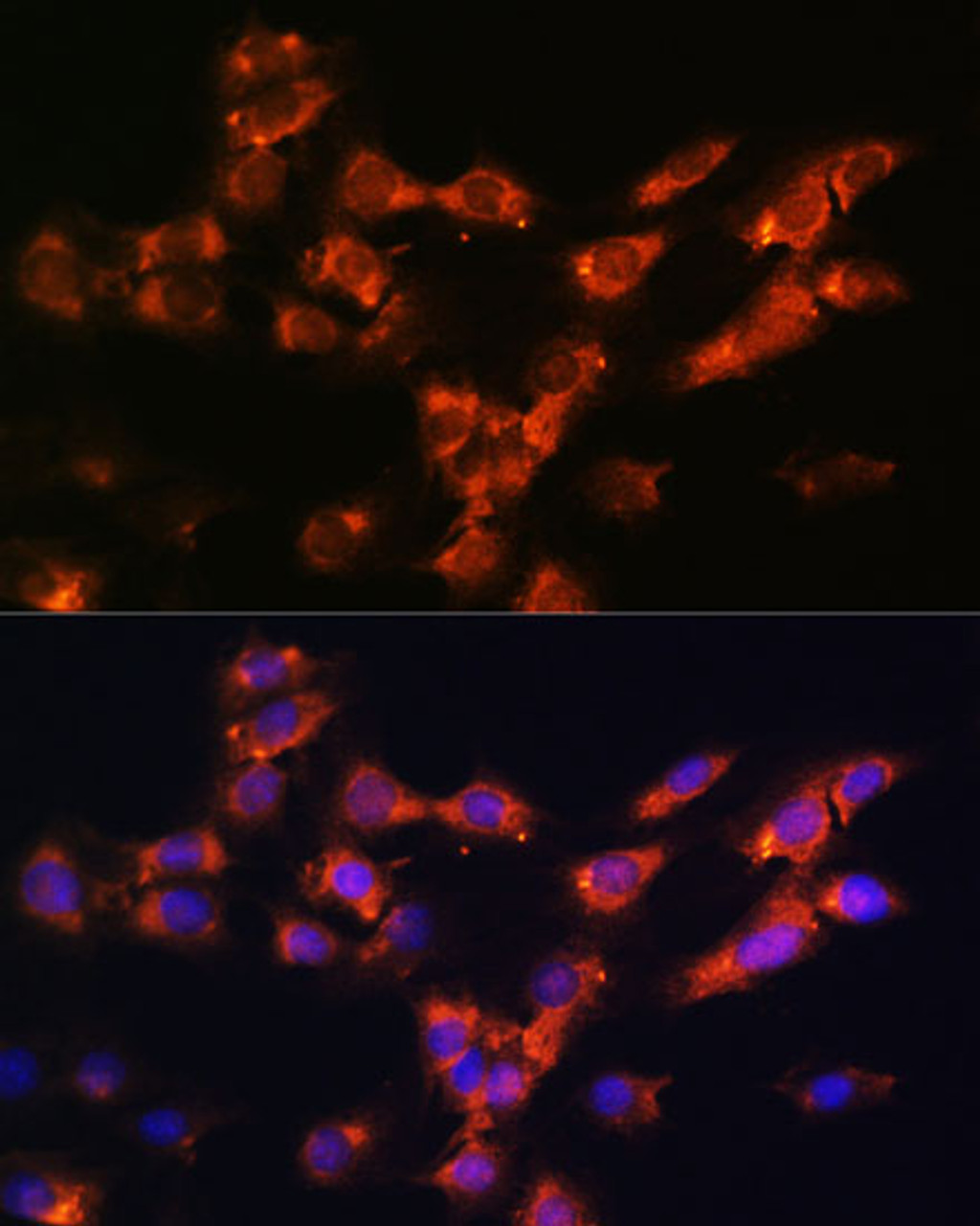 Immunofluorescence analysis of C6 cells using DPP4 Polyclonal Antibody at dilution of  1:100. Blue: DAPI for nuclear staining.